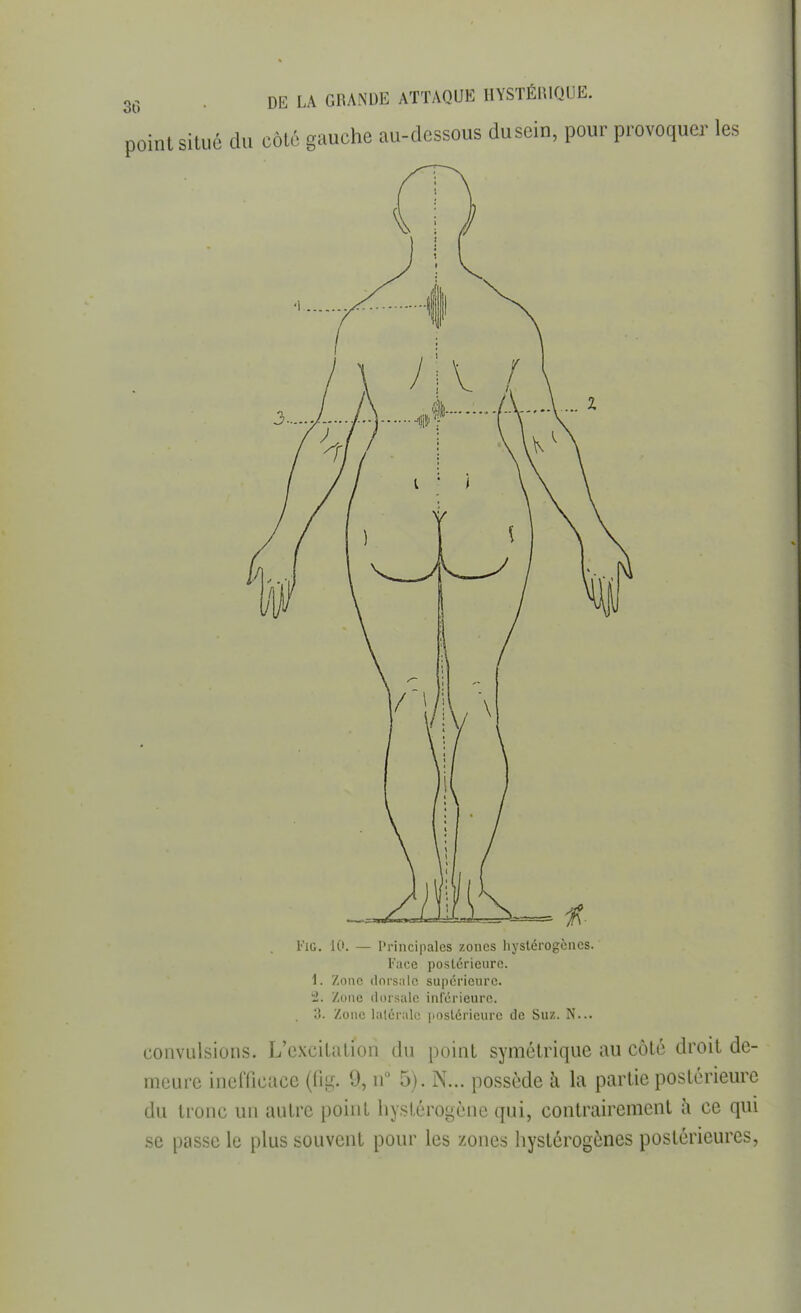 30 point situé du côté gauche au-dessous duscin, pour provoquer les Fie. 10. — Principales zones hystérogènes. Face postérieure. 1. Zone dorsale supérieure. 2. /une dorsale inférieure. 3. Zone latérale postérieure de Sue. N... convulsions. L'excitation du point symétrique au côté droit de- meure inefficace (fig. % n° 5). N... possède à la partie postérieure du tronc un autre point hyslérogène qui, contrairement à ce qui se passe le plus souvent pour les zones hystérogènes postérieures,