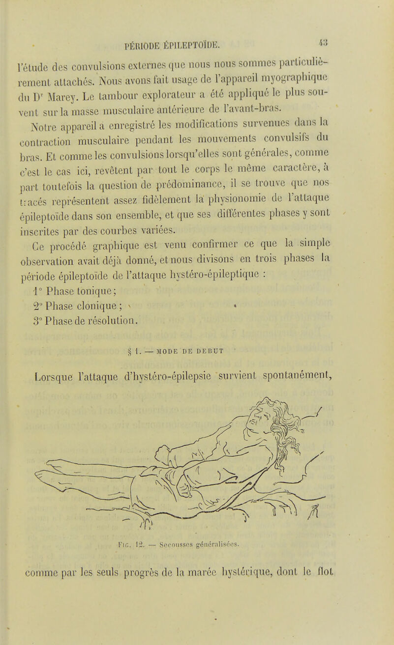 l'étude des convulsions externes que nous nous sommes particuliè- rement attachés. Nous avons fait usage de l'appareil myographique du l)r Marey. Le tambour explorateur a été appliqué le plus sou- vent sur la masse musculaire antérieure de l'avant-bras. Notre appareil a enregistré les modifications survenues dans la contraction musculaire pendant les mouvements convulsifs du bras. Et comme les convulsions lorsqu'elles sont générales, comme c'est le cas ici, revêtent par tout le corps le môme caractère, à part toutefois la question de prédominance, il se trouve que nos tracés représentent assez fidèlement la physionomie de l'attaque épileptoïde dans son ensemble, et que ses différentes phases y sont inscrites par des courbes variées. Ce procédé graphique est venu confirmer ce que la simple observation avait déjà donné, et nous divisons en trois phases la période épileptoïde de l'attaque hystéro-épileptique : 1° Phase tonique; 2° Phase clonique ; > • 3° Phase de résolution. § 1. — MODE DE DEBUT Lorsque l'attaque d'hystéro-épilepsie survient spontanément, Fie. 12. — Secousses généralisées. comme par les seuls progrès de la marée hystérique, dont le (lot