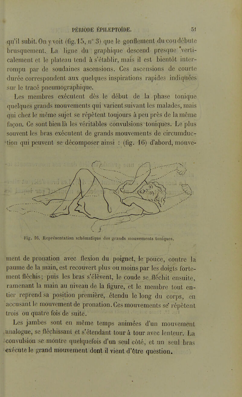 qu'il subit. On y voit (fig. 15, n° 3) que le gonflement du cou débute brusquement. La ligne du graphique descend presque 'verti- calement et le plateau tend à s'établir, mais il est bientôt inter- rompu par de soudaines ascensions. Ces ascensions de courte durée correspondent aux quelques inspirations rapides indiquées sur le tracé pneumographique. Les membres exécutent dès le début de la phase tonique quelques grands mouvements qui varient suivant les malades, mais qui chez le même sujet se répètent toujours à peu près de la même façon. Ce sont bien là les véritables convulsions toniques. Le plus souvent les bras exécutent de grands mouvements de circumduc- tion qui peuvent se décomposer ainsi : (fig. 16) d'abord, mouve- v ; . Fig. 16. Représentation schématique des grands mouvements toniques. ment de pronation avec flexion du poignet, le pouce, contre la paume de la main, est recouvert plus ou moins par les doigts forte- ment fléchis ; puis les bras s'élèvent, le coude se fléchit ensuite, ramenant la main au niveau de la figure, et le membre tout en- tier reprend sa position première, étendu le long du corps, en accusant le mouvement de pronation. Ces mouvements se* répètent trois ou quatre fois de suite. Les jambes sont en même temps animées d'un mouvement analogue, se fléchissant et s'étendant tour à tour avec lenteur. La convulsion se montre quelquefois d'un seul côté, et un seul bras exécute le grand mouvement dont il vient d'être question.