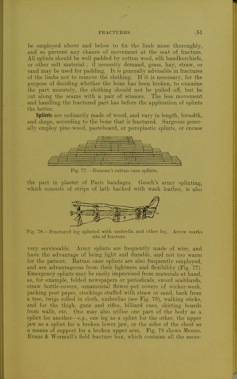 be employed above and below to fix the limb more thorougbly, and so prevent any chance of movement at the seat of fracture. All splints should be well padded by cotton wool, silk handkerchiefs, or other soft material ; if necessity demand, grass, hay, straw, or sand may be used for padding. It is generally advisable in fractures of the limbs not to remove the clothing. If it is necessary, for the purpose of deciding whether the bone has been broken, to examine the part minutely, the clothing should not be pulled off, but be cut along the seams with a pair of scissors. The less movement and handling the fractured part has before the application of splints the better. Splints are ordinarily made of wood, and vary in length, breadth, and shape, according to the bone that is fractured. Surgeons gener- ally employ pine-wood, pasteboard, or poroplastic splints, or encase Fig. 77.—Duncan's rattan cane splints. the part in plaster of Paris bandages. Gooch's army splinting, which consists of strips of lath backed with wash leather, is also Tig. 78.—Fractured leg splinted with umbrella and other leg. Arrow marks site of fracture. very serviceable. Army splints are frequently made of wire, and have the advantage of being light and durable, and not too warm for the patient. Rattan cane splints are also frequently employed, and are advantageous from their lightness and flexibility (Fig. 77). Emergency splints may be easily improvised from materials at hand, as, for example, folded newspapers or periodicals, sword scabbards, straw bottle-covers, ornamental flower-pot covers of wicker-work, packing post paper, stockings stuffed with straw or sand, bark from a tree, twigs rolled in cloth, umbrellas (see Fig. 78), walking sticks, and for the thigh, gims and rifles, billiard cues, skirting boards from walls, etc. One may also utilise one part of the body as a splint for another—e.g., one leg as a splint for the other, the upper jaw as a splint for a broken lower jaw, or the sides of the chest as a means of support for a broken upper arm. Fig. 79 shows Messrs. Evans & Wormull's field fracture box, Avhich contains all the neces-