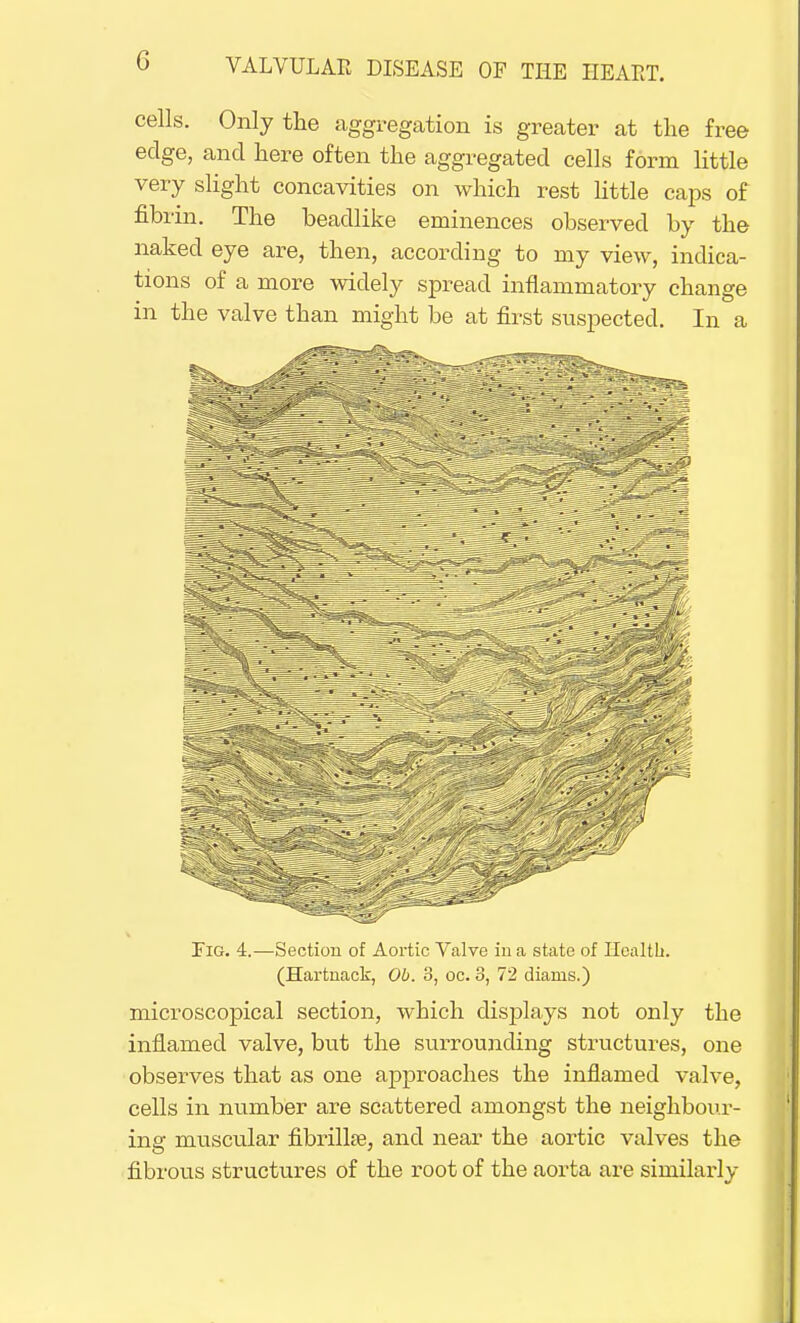 cells. Only the aggregation is greater at the free edge, and here often the aggregated cells form little very slight concavities on which rest little caps of fibrin. The beadlike eminences observed by the naked eye are, then, according to my view, indica- tions of a more widely spread inflammatory change in the valve than might be at first suspected. In a Pig. 4.—Section of Aortic Valve iu a state of Health. (Hartnack, Ob. 3, oc. 3, 72 diams.) microscopical section, which displays not only the inflamed valve, but the surrounding structures, one observes that as one approaches the inflamed valve, cells in number are scattered amongst the neighbour- ing muscular fibrillse, and near the aortic valves the fibrous structures of the root of the aorta are similarly
