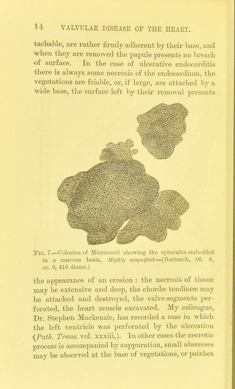 tachable, are rather firmly adherent by their base, and when they are removed the papule presents no breach of surface. In the case of ulcerative endocarditis there is always some necrosis of the endocardium, the vegetations are friable, or, if large, are attached by a wide base, the surface left by their removal presents Yig. 7.—Colonies of Micrococci snowing the spherules embedded in a mucous basis. Highly magnified.—(Hartnack, Ob. 8, oc. 8, 416 diams.) the appearance of an erosion : the necrosis of tissue may be extensive and deep, the chordse tendineje may be attacked and destroyed, the valve-segments per- forated, the heart muscle excavated. My colleague, Dr. Stephen Mackenzie, has recorded a case in which the left ventricle was perforated by the ulceration -(Path. Trans, vol. xxxiii.). In other cases the necrotic process is accompanied by suppuration, small abscesses may be observed at the base of vegetations, or patches