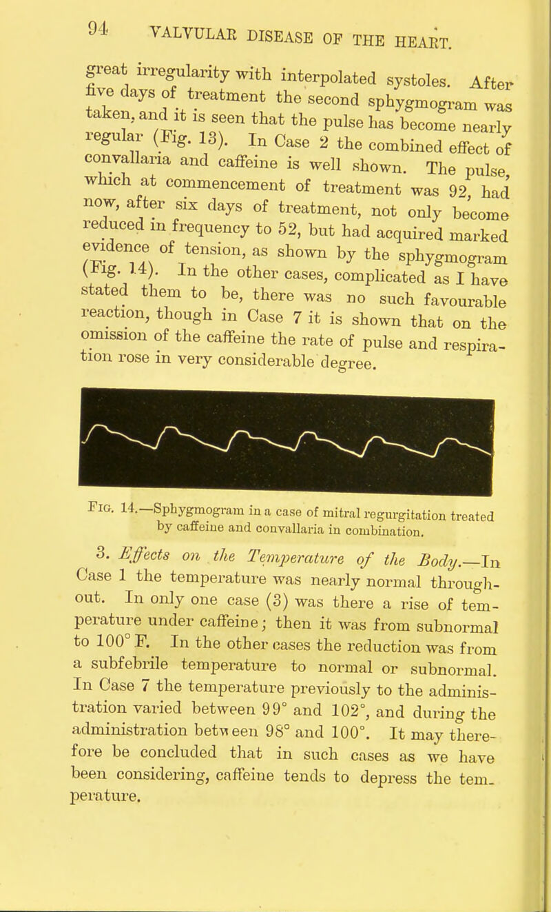 great irregularity with interpolated systoles. After hve days of treatment the second spirogram wis taken, anI it is seen that the pulse has become nearly regular (Fig. 13). In Case 2 the combined effect of convallaria and caffeine is well shown. The pulse which at commencement of treatment was 99 had now, after six clays of treatment, not only become reduced m frequency to 52, but had acquired marked evidence of tension, as shown by the sphygmogram ^ig 1.4). In the other cases, complicated as I have stated them to be, there was no such favourable reaction, though in Case 7 it is shown that on the omission of the caffeine the rate of pulse and respira- tion rose in very considerable degree. Fig. 14.—Sphygmogram in a case of mitral regurgitation treated by caffeine and convallaria in combination. 3. Effects on . the Temjjerature of the Body.—In Case 1 the temperature was nearly normal through- out. In only one case (3) was there a rise of tem- perature under caffeine; then it was from subnormal to 100° F. In the other cases the reduction was from a subfebrile temperature to normal or subnormal. In Case 7 the temperature previously to the adminis- tration varied between 99° and 102°, and during the administration between 98° and 100°. It may there- fore be concluded that in such cases as we have been considering, caffeine tends to depress the tern, perature.