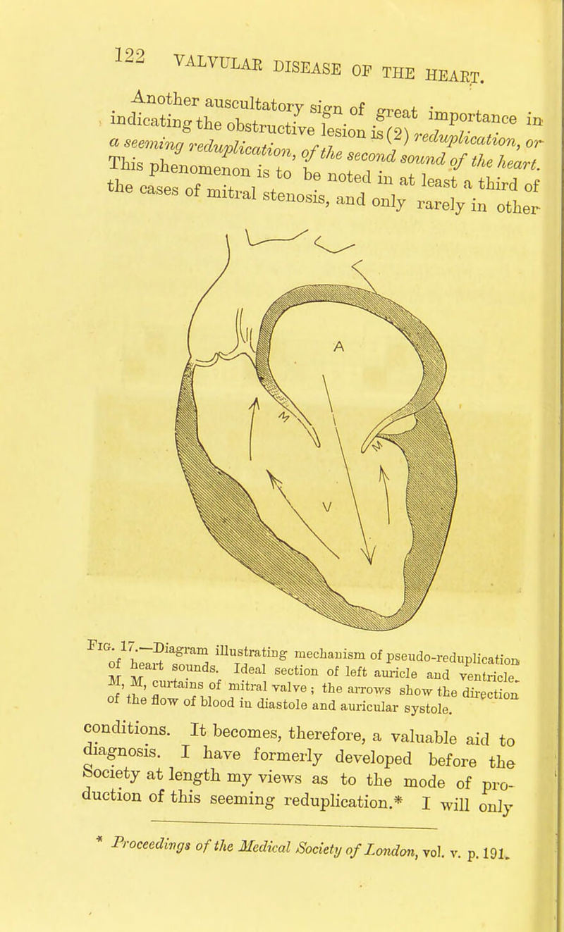 Another auscultatory si»n of „,w ■ ■udicatiug the obstructive lesiou if 2U T, * FlGnf17>;~:l?iagram mustratiD& mechanism of pseudo-reduplication of heart sounds. Ideal section of left am-icle and venSck M M, curtains 0f mitral valve ; the arrows show the di et n of the flow of blood in diastole and auricular systole. conditions. It becomes, therefore, a valuable aid to diagnosis. I Lave formerly developed before the Society at length my views as to the mode of pro- duction of this seeming reduplication * I will only * Proceedings of the Medical Society of London, vol. v. p. 191.