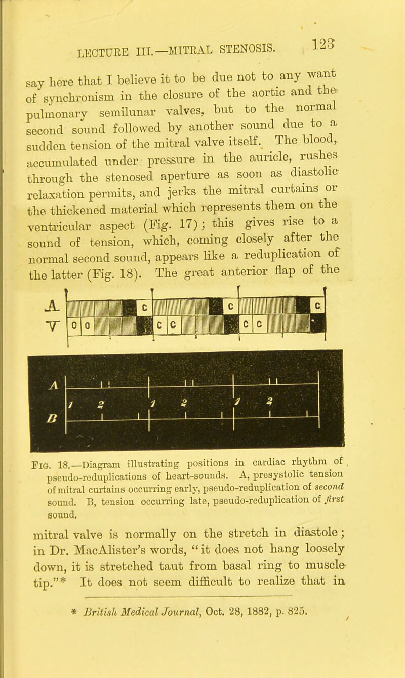 say here that I believe it to be due not to any want of synchronism in the closure of the aortic and the. pulmonary semilunar valves, but to the normal second sound followed by another sound due to a sudden tension of the mitral valve itself. The blood, accumulated under pressure in the auricle, rushes through the stenosed aperture as soon as diastolic relaxation permits, and jerks the mitral curtains or the thickened material which represents them on the ventricular aspect (Fig. 17); this gives rise to a sound of tension, which, coming closely after the normal second sound, appears like a reduplication of the latter (Fig. 18). The great anterior flap of the 1 Fig. 18.—Diagram illustrating positions in cardiac rhythm of . pseudo-reduplications of heart-sounds. A, presystolic tension of mitral curtains occurring early, pseudo-reduplication of second sound. B, tension occurring late, pseudo-reduplication of first sound. mitral valve is normally on the stretch in diastole; in Dr. MacAlister's words,  it does not hang loosely down, it is stretched taut from basal ring to muscle tip.* It does not seem difficult to realize that in * British Medical Journal, Oct. 28, 1882, p. 825.