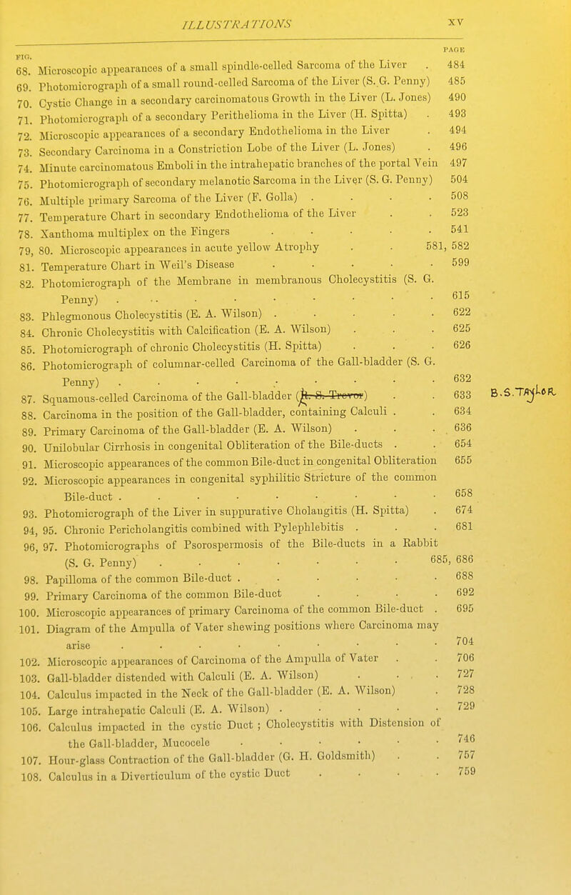 581 FIG. 68. Microscopic appearances of a small spiudle-celled Sarcoma of the Liver . 69. Photomicrograph of a small round-celled Sarcoma of the Liver (S. G. Penny) 70. Cystic Change in a secondary carcinomatous Growth in the Liver (L. Jones) 71. Photomicrograph of a secondary Perithelioma in the Liver (H. Spitta) 72. Microscopic appearances of a secondary Endothelioma in the Liver 73. Secondary Carcinoma in a Constriction Lobe of the Liver (L. Jones) 74. Minute carcinomatous Emboli in the intrahepatic branches of the portal Vein 75. Photomicrograph of secondary melanotic Sarcoma in the Liver (S. G. Penny) 76. Multiple primary Sarcoma of the Liver (F. Golla) . 77. Temperature Chart in secondary Endothelioma of the Liver 78. Xanthoma multiplex on the Fingers .... 79. 80. Microscopic appearances in acute yellow Atrophy 81. Temperature Chart in Weil's Disease .... 82. Photomicrograph of the Membrane in membranous Cholecystitis (S. G Penny) . ■ • 83. Phlegmonous Cholecystitis (E. A. Wilson) .... 84. Chronic Cholecystitis with Calcification (E. A. Wilson) 85. Photomicrograph of chronic Cholecystitis (H. Spitta) 86. Photomicrogi-aph of columnar-celled Carcinoma of the Gall-bladder (S. G Penny) 87. Squamous-celled Carcinoma of the Gall-bladder (^^r*-*i'eTOi') 88. Carcinoma in the position of the Gall-bladder, containing Calculi . 89. Primary Carcinoma of the Gall-bladder (E. A. Wilson) 90. Unilobular Cirrhosis in congenital Obliteration of the Bile-ducts . 91. Microscopic appearances of the common Bile-duct in congenital Obliteration 92. Microscopic appearances in congenital syphilitic Stricture of the common Bile-duct 93. Photomicrograph of the Liver in suppurative Cholangitis (H. Spitta) 94. 95. Chronic Pericholangitis combined with Pylephlebitis . 96, 97. Photomicrographs of Psorospermosis of the Bile-ducts in a Rabbit (S. G. Penny) 685, 98. Papilloma of the common Bile-duct . . 99. Primary Carcinoma of the common Bile-duct 100. Microscopic appearances of primary Carcinoma of the common Bile-duct 101. Diagram of the Ampulla of Vater shewing positions where Carcinoma may arise 102. Microscopic appearances of Carcinoma of the Ampulla of Vater 103. Gall-bladder distended with Calculi (E. A. Wilson) . . , 104. Calculus impacted in the Neck of the Gall-bladder (E. A. Wilson) 105. Large intrahepatic Calculi (E. A. Wilson) .... 106. Calculus impacted in the cystic Duct ; Cholecystitis with Distension o the Gall-bladder, Mucocele . . . • ■ 107. Hour-glass Contraction of the Gall-bladder (G. H. Goldsmith) 108. Calculus in a Diverticulum of the cystic Duct PAOE 484 485 490 493 494 496 497 504 508 523 541 , 582 599 615 622 625 626 632 633 B.S.TfljUfl 634 636 654 655 658 674 ' 681 686 688 692 695 704 706 727 728 729 746 757 759