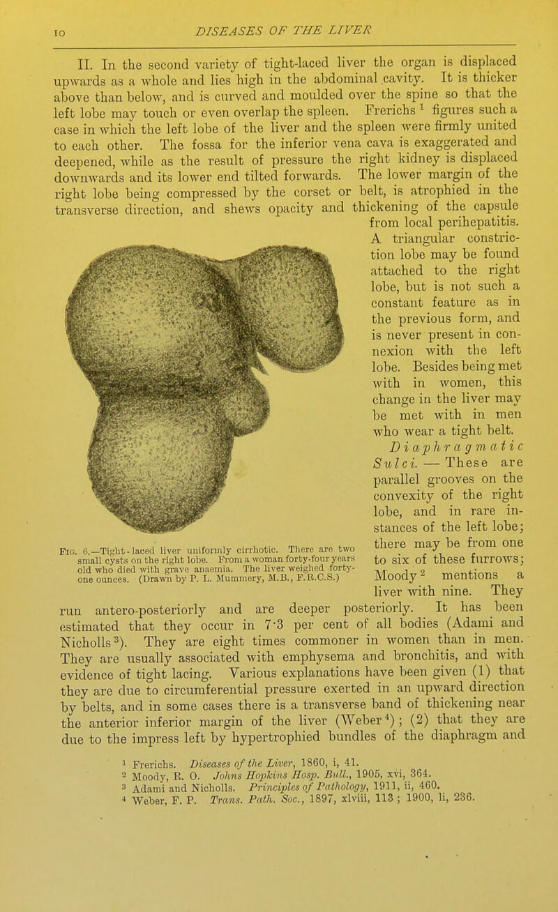 II. In the second variety of tight-laced liver the organ is displaced upwards as a whole and lies high in the abdominal cavity. It is thicker above than below, and is curved and moulded over the spine so that the left lobe may touch or even overlap the spleen. Frerichs ^ figures such a case in which the left lobe of the liver and the spleen were firmly united to each other. The fossa for the inferior vena cava is exaggerated and deepened, while as the result of pressure the right kidney is displaced downwards and its lower end tilted forwards. The lower margin of the right lobe being compressed by the corset or belt, is atrophied in the transverse direction, and shews opacity and thickening of the capsule from local perihepatitis. A triangular constric- tion lobe may be found attached to the right lobe, but is not such a constant feature as in the previous form, and is never present in con- nexion with the left lobe. Besides being met with in women, this change in the liver may be met with in men who wear a tight belt. J) i a 'ph r a g m a i i c Sulci. — These are parallel grooves on the convexity of the right lobe, and in rare in- stances of the left lobe; there may be from one to six of these furrows; Moody 2 mentions a liver with nine. They run antero-posteriorly and are deeper posteriorly. It has been estimated that they occur in 7-3 per cent of all bodies (Adarai and Nicholls ^). They are eight times commoner in women than in men. They are usually associated with emphysema and bronchitis, and with evidence of tight lacing. Various explanations have been given (1) that they are due to circumferential pressure exerted in an upward direction by belts, and in some cases there is a transverse band of thickening near the anterior inferior margin of the liver (Weber*); (2) that they are due to the impress left by hypertrophied bundles of the diaphragm and 1 Frerichs. Diseases of the Liver, 1860, i, 41. 2 Moody, R. 0. Johns Hopkins Hasp. Bull., 1905, xvi, 364. 3 Adami aud Nicholls. Principles of Pathology, 1911, ii, 460. ■> Weber, F. P. Trans. Path. Soc., 1897, xlviii, 113 ; 1900, li, 236. Fio. 6.—Tight-laced liver uniformly cirrhotic. There are two small cysts ou the right lobe. From a woman forty-four years old who died with grave anaemia. The liver weighed forty- one ounces. (Dravra by P. L. Mummery, M.B., F.R.C.S.)