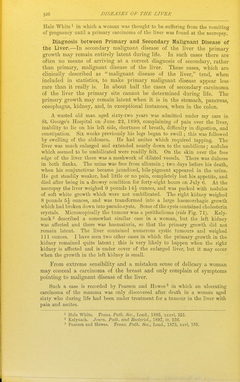 Hale White1 in which a woman was thought to be suffering from the vomiting of pregnancy until a primary carcinoma of the liver was found at the necropsy. Diagnosis between Primary and Secondary Malignant Disease of the Liver.—In secondary malignant disease of the liver the primary growth may remain entirely latent during life. In such cases there are often no means of arriving at a correct diagnosis of secondary, rather than primary, malignant disease of the liver. These cases, which are clinically described as malignant disease of the liver, tend, when included in statistics, to make primary malignant disease appear less rare than it really is. In about half the cases of secondary carcinoma of the liver the primary site cannot be determined during life. The primary growth may remain latent when it is in the stomach, pancreas, oesophagus, kidney, and, in exceptional instances, when in the colon. A wasted old man aged sixty-two years' was admitted under my care in St. George's Hospital on June 22, 1899, complaining of pain over the liver, inability to lie on his left side, shortness of breath, difficulty in digestion, and constipation. Six weeks previously his legs began to swell; this was followed by swelling of the abdomen. He had ascites which required tapping. The liver was much enlarged and extended nearly down to the umbilicus; nodules which seemed to be umbilicated were readily felt. On the skin over the free edge of the liver there was a meshwork of dilated vessels. There was dulness in both flanks. The urine was free from albumin ; two days before his death, when his conjunctivae became jaundiced, bile-pigment appeared in the urine. He got steadily weaker, had little or no pain, completely lost his appetite, and died after being in a drowsy condition for forty-eight hours on July 6. At the necropsy the liver weighed 9 pounds 14| ounces, and was packed with nodules of soft white growth which were not umbilicated. The right kidney weighed 8 pounds 5j ounces, and was transformed into a large haemorrhagic growth which had broken down into pseudo-cysts. Some of the cysts contained cholesterin crystals. Microscopically the tumour was a perithelioma (vide Fig. *71). Kely- nack2 described a somewhat similar case in a woman, but the left kidney was affected and there was haematuria, so that the primary growth did not remain latent. The liver contained numerous cystic tumours and weighed 111 ounces. I have seen two other cases in which the primary growth in the kidney remained quite latent; this is very likely to happen when the right kidney is affected and is under cover of the enlarged liver, but it may occur when the growth in the left kidney is small. From extreme sensibility and a mistaken sense of delicacy a woman may conceal a carcinoma of the breast and only complain of symptoms pointing to malignant disease of the liver. Such a case is recorded by Pearson and Howes3 in which an ulcerating carcinoma of the mamma was only discovered after death in a woman aged sixty who during life had been under treatment for a tumour in the liver with pain and ascites. 1 Hale White. Trans. Path. Soc, Lond., 1885, xxxvi, 251. 2 Kelynack. Joum. Path, and Bacteriol., 1897, iv, 236. 3 Pearson and Howes. Trans. Path. Soc, Lond., 1875, xxvi, 1S5.