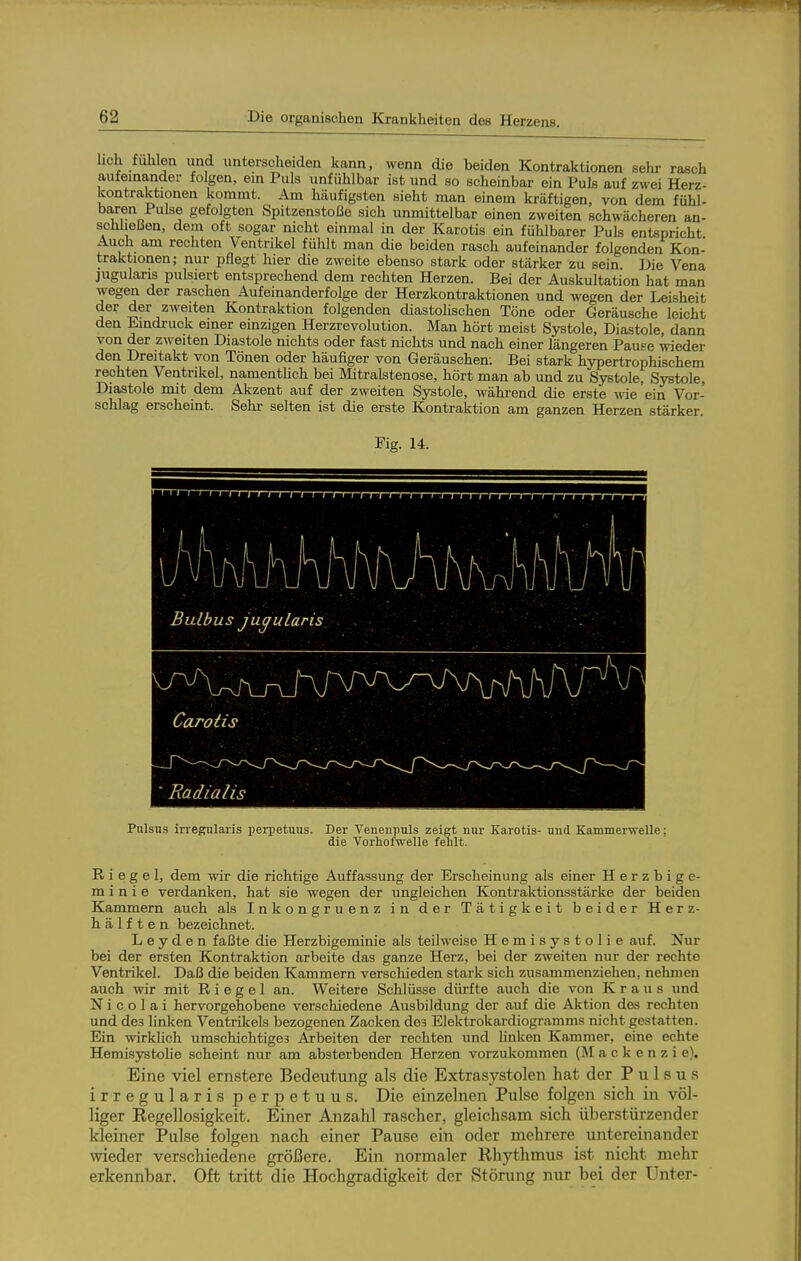 hch fühlen und unterscheiden kann, wenn die beiden Kontraktionen sehr rasch aufeinander folgen, ein Puls unfühlbar ist und so scheinbar ein Puls auf zwei Herz- kontraktionen kommt. Am häufigsten sieht man einem kräftigen, von dem fühl- baren Pulse gefolgten Spitzenstöße sich unmittelbar einen zweiten schwächeren an- scMießen, dem oft sogar nicht einmal in der Karotis ein fühlbarer Puls entspricht Auch am rechten Ventrikel fühlt man die beiden rasch aufeinander folgenden Kon- traktionen; nur pflegt hier die zweite ebenso stark oder stärker zu sein. Die Vena jugularis pulsiert entsprechend dem rechten Herzen. Bei der Auskultation hat man wegen der raschen Aufeinanderfolge der Herzkontraktionen und wegen der Leisheit der der zweiten Kontraktion folgenden diastolischen Töne oder Geräusche leicht den Eindruck einer einzigen Herzrevolution. Man hört meist Systole, Diastole, dann von der zweiten Diastole nichts oder fast nichts und nach einer längeren Pause wieder den Dreitakt von Tönen oder häufiger von Geräuschen. Bei stark hypertrophischem rechten Ventrikel, namentUch bei Mitralstenose, hört man ab und zu Systole, Systole, Diastole mit dem Akzent auf der zweiten Systole, während die erste Avie 'ein Vor- schlag erscheint. Sehr selten ist die erste Kontraktion am ganzen Herzen stärker. Fig. 14. ' ' ' ' I • I • I ' I I r~r-r—rTi i i i i i i i i i i i i i rr-r-r—i—i—i—i i i i : i i i i Carotis 'Radialis Pulsus irregularis perpetuus. Der Veneniiuls zeigt nur Karotis- und Kammerwelle; die Vorhofwelle fehlt. Riegel, dem wir die richtige Auffassung der Erscheinung als einer H e r z b i g e- minie verdanken, hat sie wegen der ungleichen Kontraktionsstärke der beiden Kammern auch als Inkongruenz in der Tätigkeit beider Herz- hälften bezeichnet. L e y d e n faßte die Herzbigeminie als teilweise Hemisystolie auf. Nur bei der ersten Kontraktion arbeite das ganze Herz, bei der zweiten nur der rechte Ventrikel. Daß die beiden Kammern verschieden stark sich zusammenziehen, nehmen auch wir mit Riegel an. Weitere Schlüsse dürfte auch die von Kraus und Nicolai hervorgehobene verschiedene Ausbildung der auf die Aktion des rechten und des linken Ventrikels bezogenen Zacken des Elektrokardiogramms nicht gestatten. Ein wirklich umschichtiges Arbeiten der rechten und linken Kammer, eine echte Hemisystolie scheint nur am absterbenden Herzen vorzukommen (ÄI a c k e n z i e). Eine viel ernstere Bedeutung als die Extrasystolen hat der Pulsus irregularis perpetuus. Die einzelnen Pulse folgen sich in völ- liger Regellosigkeit. Einer Anzahl rascher, gleichsam sich überstürzender kleiner Pulse folgen nach einer Pause ein oder mehrere untereinander wieder verschiedene größere. Ein normaler Rhythmus ist nicht mehr erkennbar. Oft tritt die Hochgradigkeit der Störung nur bei der Unter-