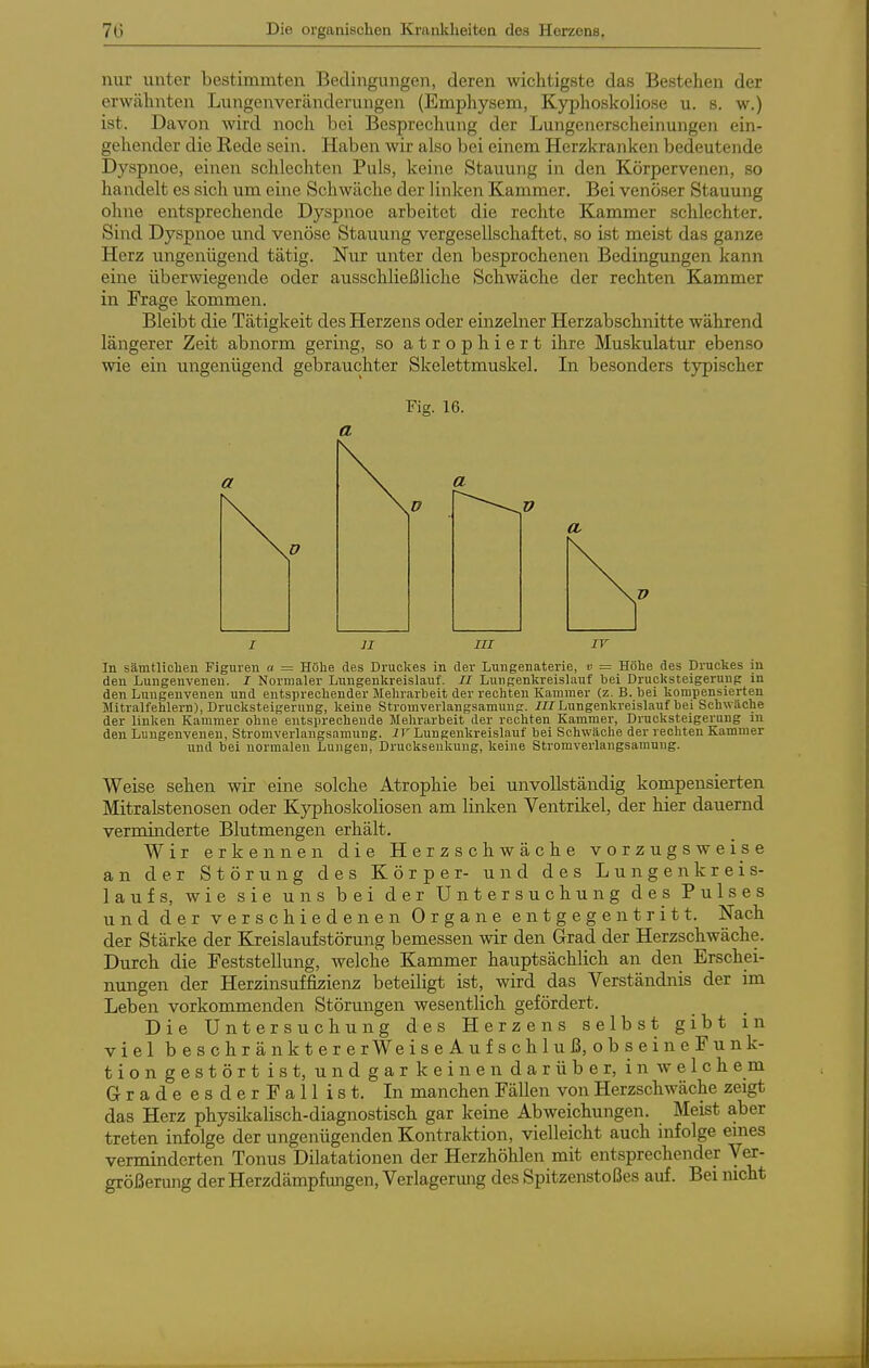 nur unter bestimmten Bedingungen, deren wichtigste das Bestehen der erwähnten Lungenveränderungen (Emphysem, Kyphoskoliose u. s. w.) ist. Davon wird noch bei Besprechung der Lungenerscheinungen ein- gehender die Kede sein. Haben wir also bei einem Herzkranken bedeutende Dyspnoe, einen schlechten Puls, keine Stauung in den Körpervenen, so handelt es sich um eine Schwäche der linken Kammer. Bei venöser Stauung ohne entsprechende Dyspnoe arbeitet die rechte Kammer schlechter. Sind Dyspnoe und venöse Stauung vergesellschaftet, so ist meist das ganze Herz ungenügend tätig. Nur unter den besprochenen Bedingungen kann eine überwiegende oder ausschließliche Schwäche der rechten Kammer in Frage kommen. Bleibt die Tätigkeit des Herzens oder einzelner Herzabschnitte während längerer Zeit abnorm gering, so atrophiert ihre Muskulatur ebenso wie ein ungenügend gebrauchter Skelettmuskel. In besonders typischer Fig. 16. a V I II III IV In sämtUclien Figuren a = Höhe des Druckes in der Lungenaterie, v = Höhe des Druckes in den Lungenveneu. I Normaler Lungenkreislauf. // Lungenkreislauf bei Drucksteigerung in den Lungenvenen und entsprechender Mehrarbeit der rechten Kammer (z. B. bei kompensierten Mitralfehlern), Drucksteigerung, keine Stromverlangsamung. /ZZLungenkreislauf bei Schwäche der linken Kammer ohne entsprechende Mehrarbeit der rechten Kammer, Drucksteigerung in den Lungenvenen, Stromverlangsamung. Jr Lungenkreislauf bei Schwäche der rechten Kammer und bei normalen Lungen, Drucksenkung, keine Stromverlangsamung. Weise sehen wir eine solche Atrophie bei unvollständig kompensierten Mitralstenosen oder Kyphoskoliosen am linken Ventrikel, der hier dauernd verminderte Blutmengen erhält. Wir erkennen die Herzschwäche vorzugsweise an der Störung des Körper- und des Lungenkreis- laufs, wie sie uns bei der Untersuchung des Pulses und der verschiedenen Organe entgegentritt. Nach der Stärke der Kreislaufstörung bemessen wir den Grad der Herzschwäche. Durch die Feststellung, welche Kammer hauptsächlich an den Erschei- nungen der Herzinsuffizienz beteiligt ist, wird das Verständnis der im Leben vorkommenden Störungen wesenthch gefördert. Die Untersuchung des Herzens selbst gibt in viel beschränktere rWe iseAufschluß, obseineFunk- tiongestörtist, undgarkeinendarüber, inweichem GradeesderFallist. In manchen Fällen von Herzschwäche zeigt das Herz physikalisch-diagnostisch gar keine Abweichungen. Meist aber treten infolge der ungenügenden Kontraktion, vielleicht auch infolge emes verminderten Tonus Dilatationen der Herzhöhlen mit entsprechender Ver- größerung der Herzdämpfungen, Verlagerung des Spitzenstoßes auf. Bei nicht