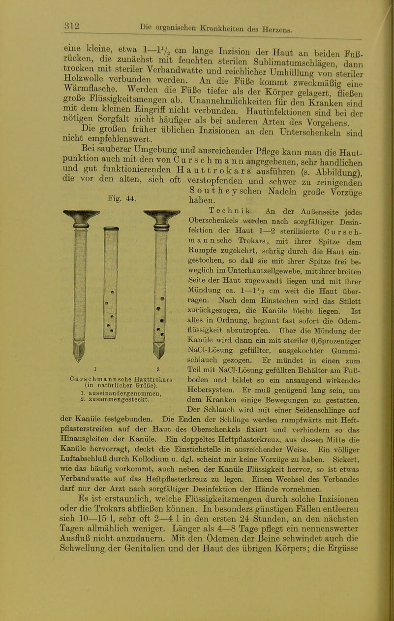 eine kleine, etwa l-P/, cm lange Inzision der Haut an beiden Fuß- rucken, die zunächst mit feuchten sterilen Sublimatumschlägen dann Rocken mit steriler Verbandwatte und reichlicher Umhüllung von steriler Holzwolle verbunden werden. An die Füße kommt zweckmäßig eine Warmflasche Werden die Füße tiefer als der Körper gelagert, fließen große Flussigkeitsmengen ab. Unannehmlichkeiten für den Kranken sind mit dem klemen Eingrifi nicht verbunden. Hautinfektionen sind bei der notigen Sorgfalt nicht häufiger als bei anderen Arten des Vorgehens Die großen früher üblichen Inzisionen an den Unterschenkeln sind nicht empfehlenswert. Bei sauberer Umgebung und ausreichender Pflege kann man die Haut- punktion auch mit den von C u r s c h m a nn angegebenen, sehr handKchen und gut funktionierenden Hauttrokars ausführen die vor den alten, sich oft verstopfenden und schwer S o u t h e y sehen Nadeln Kg- 44. haben. Technik. (s. Abbildung), zu reinigenden große Vorzüge An der Außenseite jedes Oberschenkels werden nach sorgfältiger Desin- fektion der Haut 1—2 sterihsierte Cursch- m a n n sehe Trokars, mit ihrer Spitze dem Eumpfe zugekehrt, schräg durch die Haut ein- gestochen, so daß sie mit ihrer Spitze frei be- weghch im Unterhautzellgewebe, mit ihrer breiten Seite der Haut zugewandt liegen und mit ihrer Mündung ca. 1—1'/2 cm weit die Haut über- ragen. Nach dem Einstechen wird das Stilett zurückgezogen, die Kanüle bleibt hegen. Ist alles in Ordnung, beginnt fast sofort die Ödem- flüssigkeit abzutropfen. Uber die Mündung der Kanüle wird dann ein mit steriler O.Gprozentiger NaCl-Lösung gefüllter, ausgekochter Gummi- schlauch gezogen. Er mündet in einen zum Teil mit NaCl-Lösung gefüllten Behälter am Fuß- boden und bildet so ein ansaugend wirkendes Hebersjrstem. Er muß genügend lang sein, um dem Kranken einige Bewegungen zu gestatten. Der Schlauch wird mit einer Seidenschlinge auf der Kanüle festgebunden. Die Enden der Schhnge werden rumpfwärts mit Heft- pflasterstreifen auf der Haut des Oberschenkels fixiert und verhindern so das Hinausgleiten der Kanüle. Ein doppeltes Heftpflasterkreuz, aus dessen Mitte die Kanüle hervorragt, deckt die Einstichstelle in ausreichender Weise. Ein völliger Luftabschluß durch Kollodium u. dgl. scheint mir keine Vorzüge zu haben. Sickert, wie das häufig vorkommt, auch neben der Kanüle Flüssigkeit hervor, so ist etwas Verbandwatte auf das Heftpflasterkreuz zu legen. Einen Wechsel des Verbandes darf nur der Arzt nach sorgfältiger Desinfektion der Hände vornehmen. Es ist erstaunlich, welche Flüssigkeitsmengen durch solche Inzisionen oder die Trokars abfließen können. In besonders günstigen Fällen entleeren sich 10—15 1, sehr oft 2—4 1 in den ersten 24 Stunden, an den nächsten Tagen allmählich weniger. Länger als 4—8 Tage pflegt ein nennenswerter Ausfluß nicht anzudauern. Mit den Ödemen der Beine schwindet auch die Schwellung der Genitalien und der Haut des übrigen Körpers; die Ergüsse Curschmannsche Hauttrokars (in natürlicher Größe). 1. auseinandergenommen, 2. zusammengesteckt.