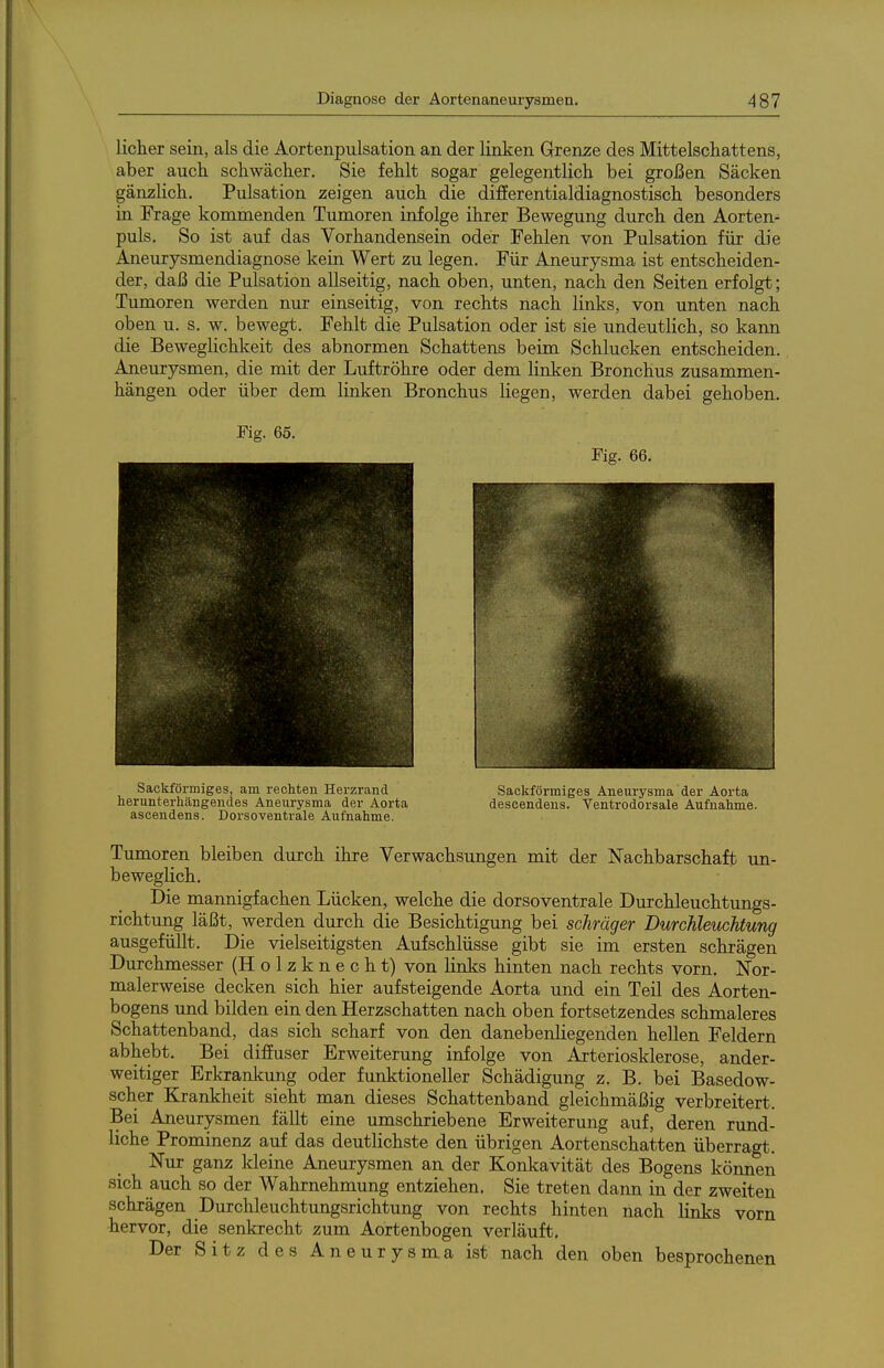 licher sein, als die Aortenpulsation an der linken Grenze des Mittelschattens, aber auch schwächer. Sie fehlt sogar gelegentlich bei großen Säcken gänzlich. Pulsation zeigen auch die differentialdiagnostisch besonders in Frage kommenden Tumoren infolge ihrer Bewegung durch den Aorten- puls. So ist auf das Vorhandensein oder Fehlen von Pulsation für die Aneurysmendiagnose kein Wert zu legen. Für Aneurysma ist entscheiden- der, daß die Pulsation allseitig, nach oben, unten, nach den Seiten erfolgt; Tumoren werden nur einseitig, von rechts nach links, von unten nach oben u. s. w. bewegt. Fehlt die Pulsation oder ist sie undeutlich, so kann die Beweglichkeit des abnormen Schattens beim Schlucken entscheiden. Aneurysmen, die mit der Luftröhre oder dem linken Bronchus zusammen- hängen oder über dem linken Bronchus liegen, werden dabei gehoben. Fig. 65. Sackförmiges, am rechten Herzrand Sackförmiges Aneurysma der Aorta herunterhängendes Aneurysma der Aorta desoendens. Ventrodorsale Aufnahme, ascendens. Dorsoventrale Aufnahme. Tumoren bleiben durch ihre Verwachsungen mit der Nachbarschaft un- beweglich. Die mannigfachen Lücken, welche die dorsoventrale Durchleuchtungs- richtung läßt, werden durch die Besichtigung bei schräger Durchleuchtung ausgefüllt. Die vielseitigsten Aufschlüsse gibt sie im ersten schrägen Durchmesser (Holzknecht) von links hinten nach rechts vorn. Nor- malerweise decken sich hier aufsteigende Aorta und ein Teil des Aorten- bogens und bilden ein den Herzschatten nach oben fortsetzendes schmaleres Schattenband, das sich scharf von den danebenHegenden hellen Feldern abhebt. Bei diffuser Erweiterung infolge von Arteriosklerose, ander- weitiger Erkrankung oder funktioneller Schädigung z. B. bei Basedow- scher Krankheit sieht man dieses Schattenband gleichmäßig verbreitert. Bei Aneurysmen fällt eine umschriebene Erweiterung auf, deren rund- liche Prominenz auf das deutlichste den übrigen Aortenschatten überragt. Nur ganz kleine Aneurysmen an der Konkavität des Bogens können sich auch so der Wahrnehmung entziehen. Sie treten dann in der zweiten schrägen Duxchleuchtungsrichtung von rechts hinten nach links vorn hervor, die senkrecht zum Aortenbogen verläuft. Der Sitz des Aneurysma ist nach den oben besprochenen