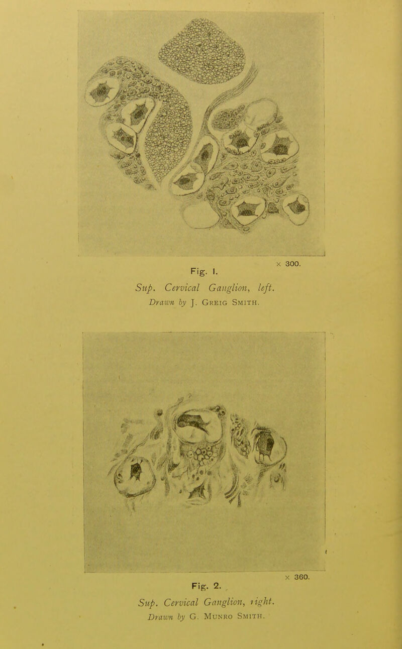 X 300. Fig. I. Sup. Cervical Ganglion, left. Drawn by J. Greig Smith. X 360. Fig. 2. Sup. Cervical Ganglion, light. Draivn by G. Munro Smith.