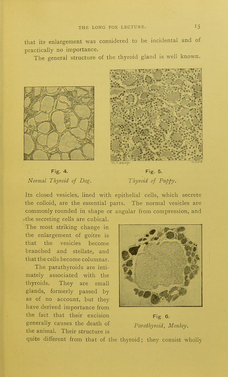 tliat its enlargement was practically no importance The general structure THE LONG FOX LECTURE. 15 considered to be incidental and of of the thyroid gland is well known ■•.si- e-c' -it ■■V. • |0 • * Fig. 4. Normal Thyroid of Dog. Fig. 5. Thyroid of Puppy. Its closed vesicles, lined with epithelial cells, which secrete the colloid, are the essential parts. The normal vesicles are commonly rounded in shape or angular from compression, and •the secreting cells are cubical. The most striking change in the enlargement of goitre is that the vesicles become branched and stellate, and that the cells become columnar. The parathyroids are inti- mately associated with the thyroids. They are small glands, formerly passed by as of no account, but they have derived importance from the fact that their excision generally causes the death of the animal. Their structure is quite different from that of the thyroid; they consist wholly Fig. 6. Parathyroid, Monkey.