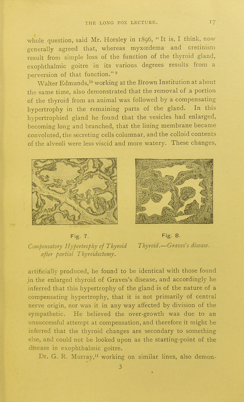 whole question, said Mr. Horsley in 1896,  It is, I think, now generally agreed that, whereas myxcedema and cretinism result from simple loss of the function of the thyroid gland, exophthalmic goitre in its various degrees results from a perversion of that function.'' Walter Edmunds,^** working at the Brown Institution at about the same time, also demonstrated that the removal of a portion of the thyroid from an animal was followed by a compensating hypertrophy in the remaining parts of the gland. In this hypertrophied gland he found that the vesicles had enlarged, becoming long and branched, that the lining membrane became convoluted, the secreting cells columnar, and the colloid contents of the alveoli were less viscid and more watery. These changes, *-v^^^-«<-> ' ...... Jfli 1 Fig. 7. Fig. 8. Compensatory Hypertrophy of Thyroid Thyroid.—Graves's disease, after partial Thyroidectomy. artificially produced, he found to be identical with those found in the enlarged thyroid of Graves's disease, and accordingly he inferred that this hypertrophy of the gland is of the nature of a compensating hypertrophy, that it is not primarily of central nerve origin, nor was it in any way affected by division of the sympathetic. He believed the over-growth was due to an unsuccessful attempt at compensation, and therefore it might be inferred that the thyroid changes are secondary to something else, and could not be looked upon as the starting-point of the disease in exophthalmic goitre. Dr. G. R. Murray, working on similar lines, also demon- 3