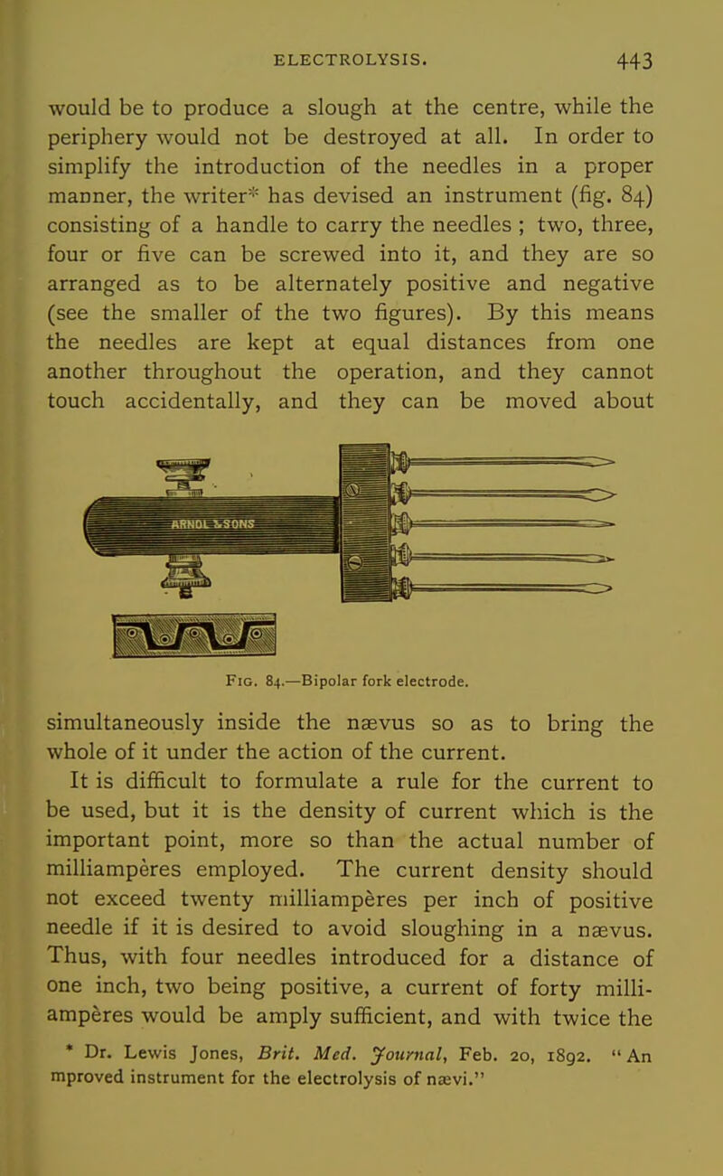 would be to produce a slough at the centre, while the periphery would not be destroyed at all. In order to simplify the introduction of the needles in a proper manner, the writer''' has devised an instrument (fig. 84) consisting of a handle to carry the needles ; two, three, four or five can be screwed into it, and they are so arranged as to be alternately positive and negative (see the smaller of the two figures). By this means the needles are kept at equal distances from one another throughout the operation, and they cannot touch accidentally, and they can be moved about Fig. 84.—Bipolar fork electrode. simultaneously inside the naevus so as to bring the whole of it under the action of the current. It is difficult to formulate a rule for the current to be used, but it is the density of current which is the important point, more so than the actual number of milhamperes employed. The current density should not exceed twenty milliamperes per inch of positive needle if it is desired to avoid sloughing in a naevus. Thus, with four needles introduced for a distance of one inch, two being positive, a current of forty milli- amperes would be amply sufficient, and with twice the * Dr. Lewis Jones, Brit. Med. Journal, Feb. 20, 1892.  An mproved instrument for the electrolysis of naevi.