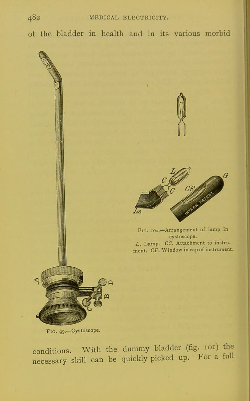 ot the bladder in health and in its various morbid Fig. 99.—Cystoscope. Fig. 100.—Arrangement of lamp in cystoscope. L. Lamp. CC. Attachment to instru- ment. CF. Window in cap of instrument. conditions. With the dummy bladder (fig. loi) necessary sldU can be quickly picked up. For a