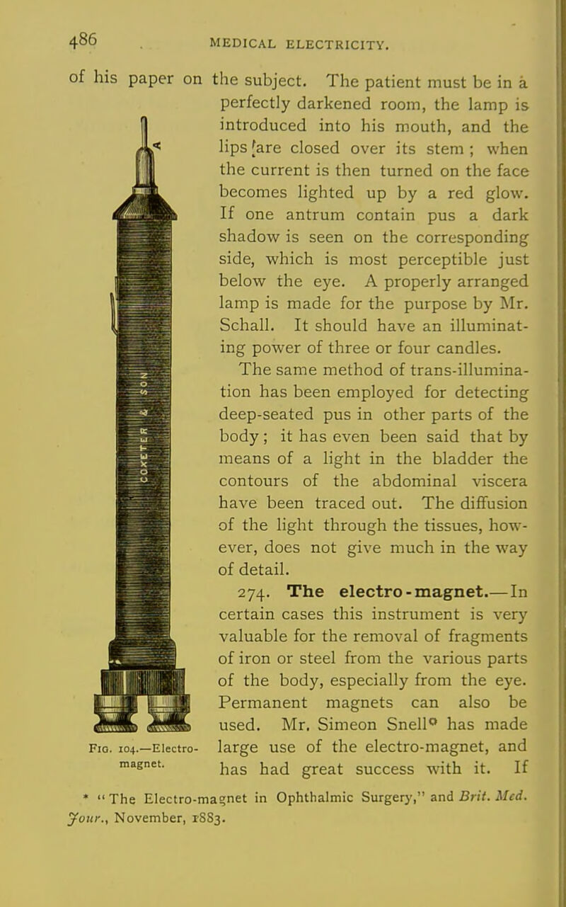 of his paper on the subject. The patient must be in a perfectly darkened room, the lamp is introduced into his mouth, and the lips [are closed over its stem ; when the current is then turned on the face becomes lighted up by a red glow. If one antrum contain pus a dark shadow is seen on the corresponding side, which is most perceptible just below the eye. A properly arranged lamp is made for the purpose by Mr. Schall. It should have an illuminat- ing power of three or four candles. The same method of trans-illumina- tion has been employed for detecting deep-seated pus in other parts of the body ; it has even been said that by means of a Hght in the bladder the contours of the abdominal viscera have been traced out. The diffusion of the light through the tissues, how- ever, does not give much in the way of detail. 274. The electro-magnet.—In certain cases this instrument is very valuable for the removal of fragments of iron or steel from the various parts of the body, especially from the eye. Permanent magnets can also be used. Mr. Simeon Snell has made large use of the electro-magnet, and has had great success with it. If • The Electro-magnet in Ophthalmic Surgery, and Brit. Med. your., November, PSS3. Fio. 104.—Electro- magnet.