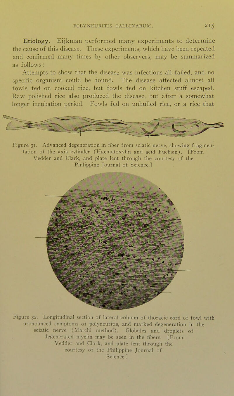 Etiology. Eijkman performed many experiments to determine the cause of this disease. These experiments, which have been repeated and confirmed many times by other observers, may be summarized as follows: Attempts to show that the disease was infectious all failed, and no specific organism could be found. The disease affected almost all fowls fed on cooked rice, but fowls fed on kitchen stuff escaped. Raw polished rice also produced the disease, but after a somewhat longer incubation period. Fowls fed on unhulled rice, or a rice that Figure 31. Advanced degeneration in fiber from sciatic nerve, showing fragmen- tation of the axis cyhnder (Haematoxylin and acid Fuchsin). [From Vedder and Clark, and plate lent through the courtesj' of the Philippine Journal of Science.] Figure 32. Longitudinal section of lateral column of thoracic cord of fowl with pronounced symptoms of polyneuritis, and marked degeneration in the sciatic nerve (Marchi method). Globules and droplets of degenerated myelin may be seen in the fibers. [From Vedder and Clark, and plate lent through the courtesy of the Philippine Journal of Science.!