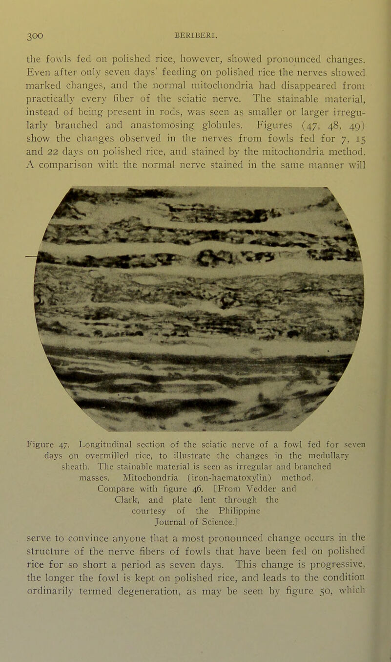 the fowls feci on polished rice, however, showed pronounced changes. Even after only seven days' feeding on polished rice the nerves showed marked changes, and the normal mitochondria had disappeared from practically every fiber of the sciatic nerve. The stainable material, instead of being present in rods, was seen as smaller or larger irregu- larly branched and anastomosing globules. Figures (47, 48, 49) show the changes observed in the nerves from fowls fed for 7, 15 and 22 days on polished rice, and stained by the mitochondria method. A comparison with the normal nerve stained in the same manner will Figure 47. Longitudinal section of the sciatic nerve of a fowl fed for seven daj's on overmilled rice, to illustrate the changes in the medullary sheath. The stainable material is seen as irregular and branched masses. Mitochondria (iron-haematoxjdin) method. Compare with figure 46. [From Vedder and Clark, and plate lent through the courtesy of the Philippine Journal of Science.] serve to convince anyone that a most pronounced change occurs in the structure of the nerve fibers of fowls that have been fed on polished rice for so short a period as seven days. This change is progressive, the longer the fowl is kept on polished rice, and leads to the condition ordinarily termed degeneration, as may be seen by figure 50, which