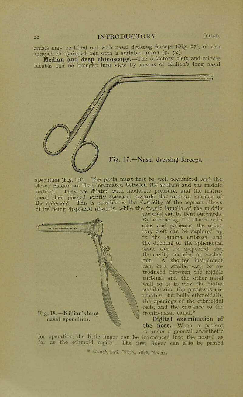 crusts may be lifted out with nasal dressing forceps (Fig. 17), or else sprayed or syringed out with a suitable lotion (p. 52). Median and deep rhinoscopy.—The olfactory cleft and middle meatus can be brought into view by means of Kilhan's long nasal speculum (Fig. 18). The parts must first be well cocainized, and the closed blades are then insinuated between the septum and the middle turbinal. They are dilated with moderate pressure, and the instru- ment then pushed gently fonvard towards the anterior surface of the sphenoid. This is possible as the elasticity of the septum allows of its being displaced inwards, while the fragile lamella of the middle turbinal can be bent outwards. By advancing the blades with care and patience, the olfac- tory cleft can be explored up to the lamina cribrosa, and the opening of the sphenoidal sinus can be inspected and the cavity sounded or washed out. A shorter instrument can, in a similar wa}', be in- troduced between the middle turbinal and the other nasal wall, so as to view the hiatus semilunaris, the processus un- cinatus, the bulla clhmoidalis, the openings of the ethmoidal cells, and the entrance to the fronto-nasal canal.* Digital examination of the nose.—When a patient is under a geneial anaesthetic for operation, the Httlc finger can be introduced into the nostril as far as the ethmoid region. The first finger can also be passed ♦ Mrmch. med. Woch., 1896, No. 33.