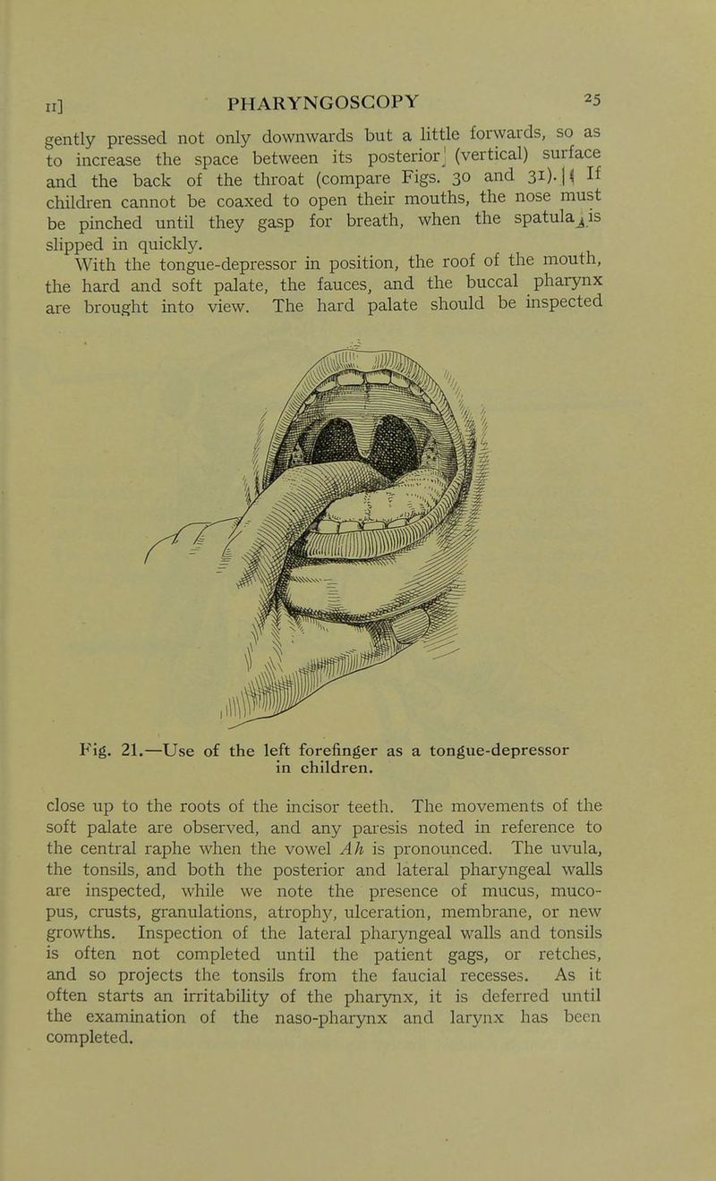 gently pressed not only downwards but a little forwards, so as to increase the space between its posterior^ (vertical) surface and the back of the throat (compare Figs. 30 and 31). | ^ If children cannot be coaxed to open their mouths, the nose must be pinched until they gasp for breath, when the spatula^is slipped in quickly. With the tongue-depressor in position, the roof of the mouth, the hard and soft palate, the fauces, and the buccal pharynx are brought into view. The hard palate should be inspected close up to the roots of the incisor teeth. The movements of the soft palate are observed, and any paresis noted in reference to the central raphe when the vowel Ah is pronounced. The uvula, the tonsils, and both the posterior and lateral pharyngeal walls are inspected, while we note the presence of mucus, muco- pus, crusts, granulations, atroph}^ ulceration, membrane, or new growths. Inspection of the lateral pharyngeal walls and tonsils is often not completed until the patient gags, or retches, and so projects the tonsils from the faucial recesses. As it often starts an irritability of the pharynx, it is deferred until the examination of the naso-pharynx and larynx has been completed.