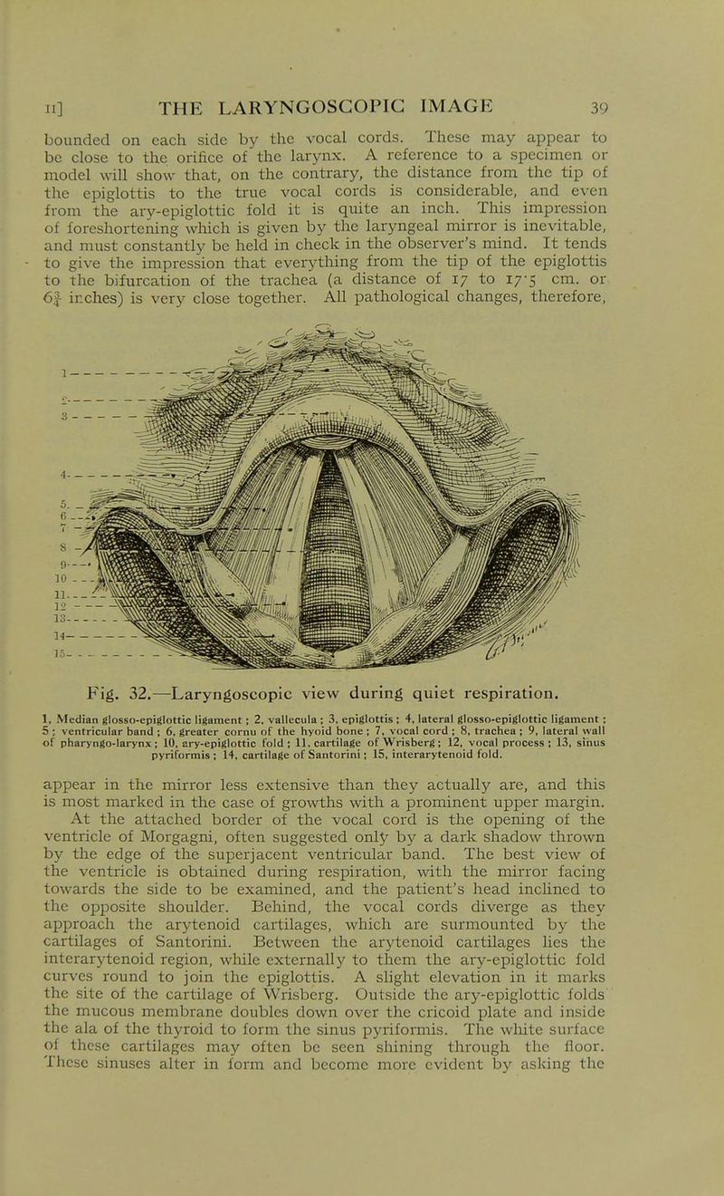 bounded on each side by the vocal cords. These may appear to be close to the orifice of the larynx. A reference to a specimen or model will show that, on the contrary, the distance from the tip of the epiglottis to the true vocal cords is considerable, and even from the ary-epiglottic fold it is quite an inch. This impression of foreshortening which is given by the laryngeal mirror is inevitable, and must constantly be held in check in the observer's mind. It tends to give the impression that everything from the tip of the epiglottis to the bifurcation of the trachea (a distance of 17 to 17-5 cm. or 6|- inches) is very close together. All pathological changes, therefore, Fig. 32.—Laryngoscopic view during quiet respiration. 1, Median glosso-epiglottic ligament; 2, vallecula ; 3, epiglottis ; 4, lateral glosso-epiglottic ligament; 5 ; ventricular band ; 6, greater cornu of the hyoid bone ; 7, vocal cord ; 8, trachea ; 9, lateral wall of pharyngo-larynx; 10, ary-epiglottic fold; 11. cartilage of Wrisberg; 12, vocal process; 13, sinus pyriformis ; 14, cartilage of Santorini; 15, interarytenoid fold. appear in the mirror less extensive than they actually are, and this is most marked in the case of gro^vths with a prominent upper margin. At the attached border of the vocal cord is the opening of the ventricle of Morgagni, often suggested only by a dark shadow thrown by the edge of the superjacent ventricular band. The best view of the ventricle is obtained during respiration, with the mirror facing towards the side to be examined, and the patient's head inclined to the opposite shoulder. Behind, the vocal cords diverge as they approach the arytenoid cartilages, which are surmounted by the cartilages of Santorini. Between the arytenoid cartilages lies the interarytenoid region, while externally to them the ary-epiglottic fold curves round to join the epiglottis. A slight elevation in it marks the site of the cartilage of Wrisberg. Outside the ary-epiglottic folds the mucous membrane doubles down over the cricoid plate and inside the ala of the thyroid to form the sinus pyiiformis. The white surface of these cartilages may often be seen shining through the floor. These sinuses alter in form and become more evident by asking the