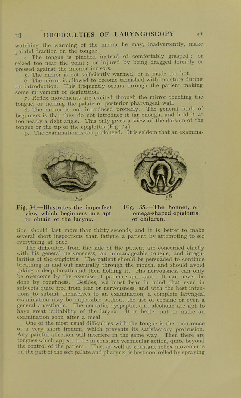 watching the warming of the mirror he may, inadvertently, make painful traction on the tongue. 4. The tongue is pinched instead of comfortably grasped ; or seized too near the point ; or injured by being dragged forcibly or pressed against the inferior incisors. 5. The mirror is not sufficiently warmed, or is made too hot. 6. The mirror is ahowed to become tarnished with moisture during its introduction. This frequently occurs through the patient making some movement of deglutition. 7. Reflex movements are excited through the mirror touching the tongue, or tickling the palate or posterior pharyngeal wall. 8. The mirror is not introduced properly. The general fault of beginners is that they do not introduce it far enough, and hold it at too nearly a right angle. This only gives a view of the dorsum of th? tongue or the tip of the epiglottis (Fig. 34). 9. The examination is too prolonged. It is seldom that an examina- Fig. 34.—Illustrates the imperfect Fig. 35.—The bonnet, or view which beginners are apt omega-shaped epiglottis to obtain of the larynx. of children. tion should last more than thirty seconds, and it is better to make several short inspections than fatigue a patient by attempting to see everything at once. The difficulties from the side of the patient are concerned chiefly with his general nervousness, an unmanageable tongue, and irregu- larities of the epiglottis. The patient should be persuaded to continue breathing in and out naturally through the mouth, and should avoid taking a deep breath and then holding it. His nervousness can only be overcome by the exercise of patience and tact. It can never be done by roughness. Besides, we must bear in mind that even in subjects quite free from fear or nervousness, and with the best inten- tions to submit themselves to an examination, a complete laryngeal examination may be impossible without the use of cocaine or even a general anaesthetic. The neurotic, dyspeptic, and alcoholic are apt to have great irritability of the larynx. It is better not to make an examination soon after a meal. One of the most usual difficulties with the tongue is the occurrence of a very short frenum, which prevents its satisfactory protrusion. Any painful affection will interfere in the same way. Then there are tongues which appear to be in constant vermicular action, quite beyond the control of the patient. This, as well as constant reflex movements on the part of the soft palate and pharynx, is best controlled by spraying