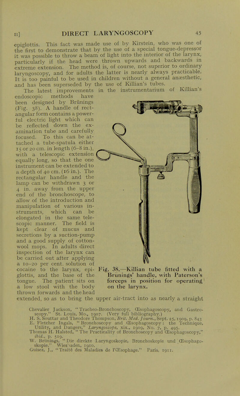 epiglottis. This fact was made use of by Kirstein, who was one of thefirst to demonstrate that by the use of a special tongue-depressor it was possible to throw a beam of light into the interior of the larynx, particularly if the head were thrown upwards and backwards m extreme extension. The method is, of course, not superior to ordinary laryngoscopy, and for adults the latter is nearly always practicable. It is too painful to be used in children without a general anaesthetic, and has been superseded by the use of Kilhan's tubes. The latest improvements in the instrumentarium of Killian's endoscopic methods have been designed by Briinings (Fig. 38). A handle of rect- angular form contains a power- ful electric light which can be reflected down the ex- amination tube and carefully focused. To this can be at- tached a tube-spatula either 15 or 20 cm. in length (6-8 in.), with a telescopic extension equally long, so that the one instrument can be extended to a depth of 40 cm. (16 in.). The rectangular handle and the lamp can be withdrawn 3 or 4 in. away from the upper end of the bronchoscope, to allow of the introduction and manipulation of various in- struments, which can be elongated in the same tele- scopic manner. The field is kept clear of mucus and secretions by a suction-pump and a good supply of cotton- wool mops. In adults direct inspection of the larynx can be carried out after applying a 10-20 per cent, solution of cocaine to the larynx, epi- Fig. 38.—Killian tube fitted with a glottis, and the base of the Briinings' handle, with Paterson's tongue. The patient sits on forceps in position for operating' a low stool with the body on the larynx, thrown forwards and the head extended, so as to bring the upper air-tract into as nearly a straight Chevalier Jackson,  Tracheo-Bronchoscopy, CEsophagoscopy, and Gastro- scopy. St. Louis, Mo., 1907. (Very full bibliography.) H. S. Souttar and Theodore Thompson, Brit. Med. Journ., Sept. 25,1909, p. 843 E. Fletcher Ingals,  Bronchoscopy and QJsophagoscopy : the Technique, Utility, and Dangers, Laryngoscope, xix., 1909, No. 7, p. 495. Thomas H. Halsted, The Practicality of Bronchoscopy and CEsophagoscopy, ibid., p. 519. W. Briinings, Die direkte Laryngoskopie, Bronchoskopie und'OEsophago- skopie. Wies'iaden, 1910. Guisez, J,, Traite des Maladies de I'CEsophage. Paris, 1911.