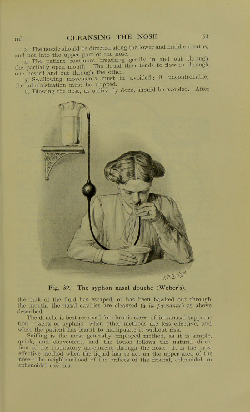 3. The nozzle should be directed along the lower and middle meatus, and not into the upper part of the nose. , ^ , 4 The patient continues breathing gently in and out through the partially open mouth. The hquid then tends to flow m through one nostril and out through the other. ^ „ , , 5. Swallowing movements must be avoided; if uncontrollable, the administration must be stopped. 6. Blowing the nose, as ordinarily done, should be avoided. Alter Fig. 39.—The syphon nasal douche (Weber's). the bulk of the fluid has escaped, or has been hawked out through the mouth, the nasal cavities are cleansed {ci la paysanne) as above described. The douche is best reserved for chronic cases of intranasal suppura- tion—ozsena or sypliihs—when other methods are less effective, and when the patient has learnt to manipulate it without risk. Sniffing is the most generally employed method, as it is simple, quick, and convenient, and the lotion follows the natural direc- tion of the inspiratory air-current through the nose. It is the most effective method when the liquid has to act on the upper area of the nose—the neighbourhood of the orifices of the frontal, ethmoidal, or sphenoidal cavities.