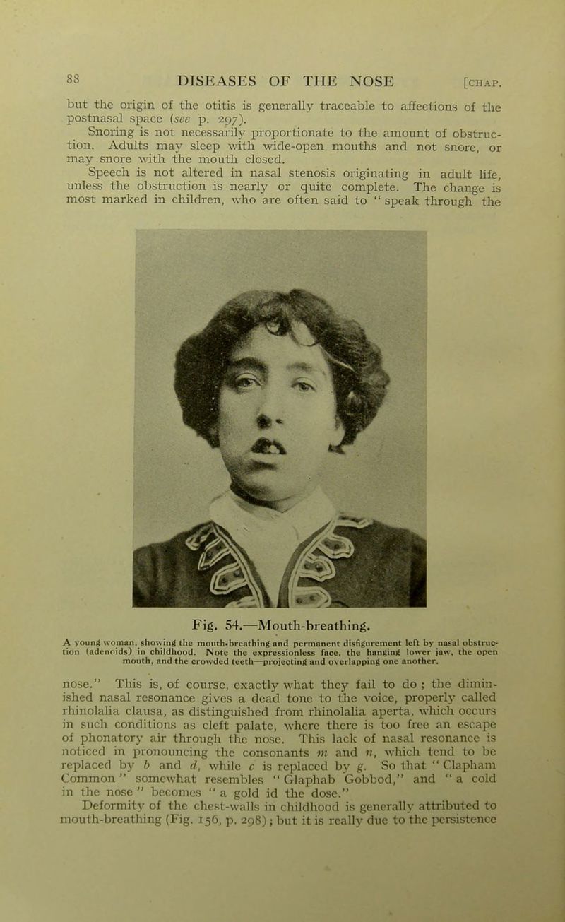 but the origin of the otitis is generally traceable to affections of the postnasal space {see p. 297). Snoring is not necessarily proportionate to the amount of obstruc- tion. Adults may sleep with wide-open mouths and not snore, or may snore vdth the mouth closed. Speech is not altered in nasal stenosis originating in adult life, unless the obstruction is nearly or quite complete. The change is most marked in children, who are often said to  speak through the Fig. 54.—Mouth-breathing. A young woman, showing the mouth-breathing and permanent disfigurement left by nasal obstruc- tion (adenoids) in childhood. Note the expressionless face, the hanging lower jaw, the open mouth, and the crowded teeth—projecting and overlapping one another. nose. This is, of course, exactly what they fail to do ; the dimin- ished nasal resonance gives a dead tone to the voice, properlj- called rhinolalia clausa, as distinguished from rhinolaha aperta, which occurs in such conditions as cleft palate, where there is too free an escape of phonatory air through the nose. This lack of nasal resonance is noticed in pronouncing the consonants m and n, which tend to be replaced by b and d, while c is replaced by g. So that  Clapham Common somewhat resembles  Glaphab Gobbod, and  a cold in the nose  becomes  a gold id the dose. Deformity of the chest-walls in childhood is generally attributed to mouth-breathing (Fig. 156, p. 298); but it is really due to the persistence