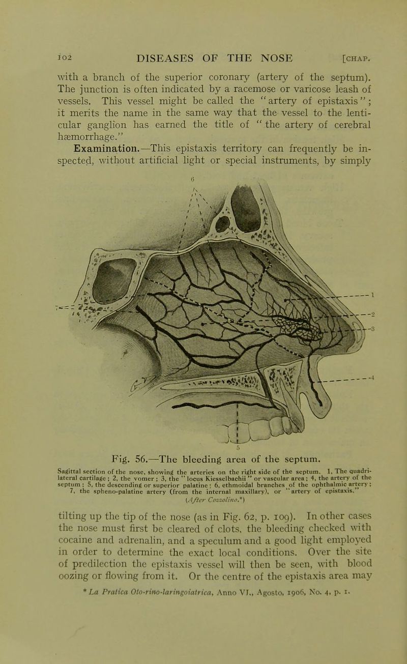 with a branch of the superior coronary (artery of the septum). The junction is often indicated by a racemose or varicose leash of vessels. This vessel might be called the artery of epistaxis; it merits the name in the same way that the vessel to the lenti- cular ganglion has earned the title of the artery of cerebral hfemorrhage. Examination.—This epistaxis territory can frequently be in- spected, without artificial light or special instruments, by simply (5 Fig. 56.—The bleeding area of the septum. Sagittal section of the nose, showing the arteries on the right side of the septum. 1, The quadri- lateral cartilage ; 2, the vomer ; 3, the locus Kiesselbachii or vascular area; 4. the artery of the septum; 5, the descending or superior palatine; 6, ethmoidal branches of the ophthalmic artery; 7, the spheno-palatine artery (from the internal maxillary), or artery of epistaxis. {After Cozzolhw.*) tilting up the tip of the nose (as in Fig. 62, p. log). In other cases the nose must first be cleared of clots, the bleeding checked with cocaine and adrenalin, and a speculum and a good light employed in order to determine the exact local conditions. Over the site of predilection the epistaxis vessel will then be seen, with blood oozing or flowing from it. Or the centre of the epistaxis area may * La Praiica Oto-rino-laringoiatrica, Anno VI., Agosto, 1906, No. 4, p. i.