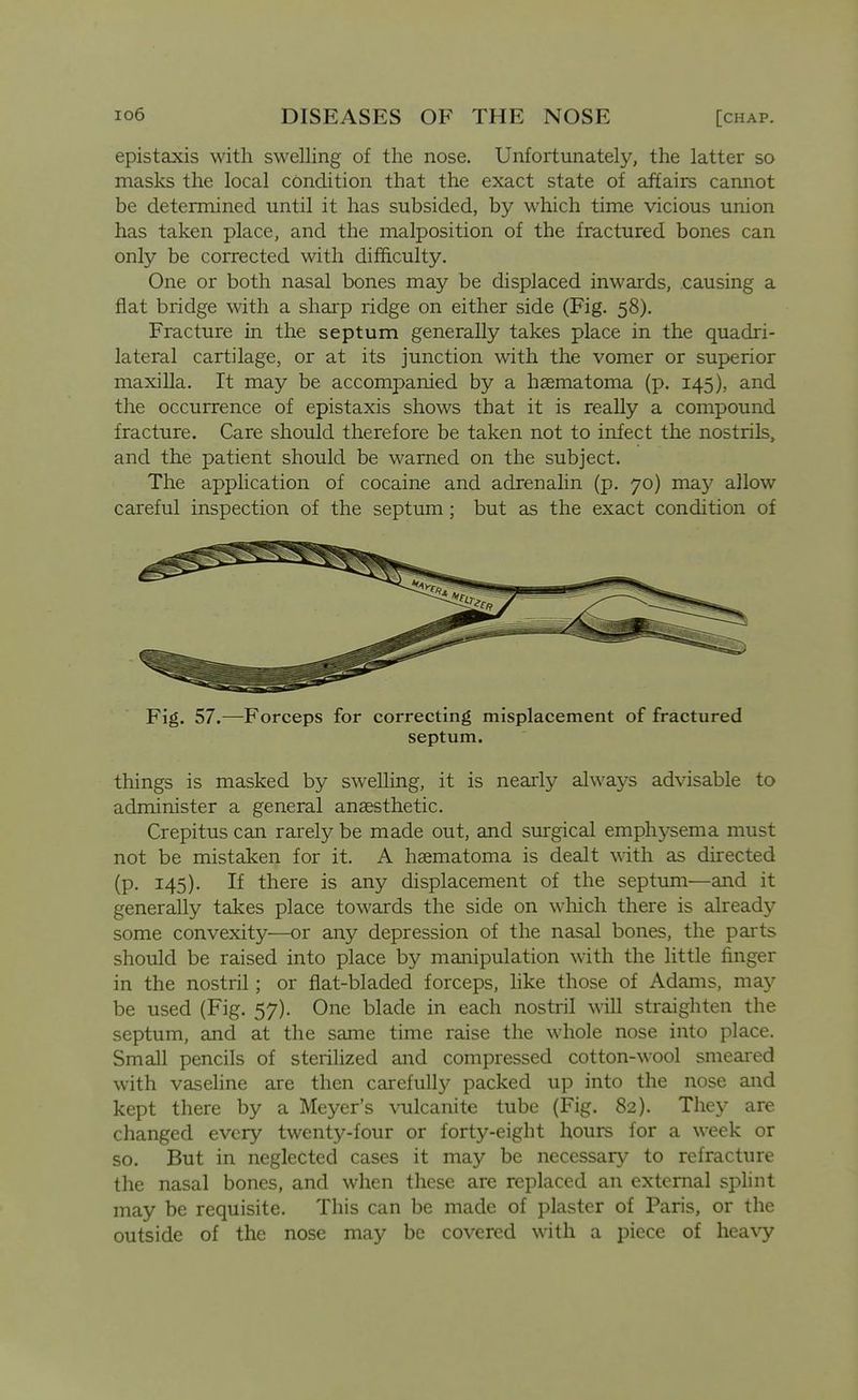 epistaxis with swelling of the nose. Unfortunately, the latter so masks the local condition that the exact state of affairs cannot be determined until it has subsided, by which time vicious union has taken place, and the malposition of the fractured bones can only be corrected with difficulty. One or both nasal bones may be displaced inwards, causing a fiat bridge with a sharp ridge on either side (Fig. 58). Fracture in the septum generally takes place in the quadri- lateral cartilage, or at its junction with the vomer or superior maxilla. It may be accompanied by a hasmatoma (p. 145), and the occurrence of epistaxis shows that it is really a compound fracture. Care should therefore be taken not to infect the nostrils, and the patient should be warned on the subject. The application of cocaine and adrenalin (p. 70) may allow careful inspection of the septum; but as the exact condition of Fig. 57.—Forceps for correcting misplacement of fractured septum. things is masked by swelling, it is nearly always advisable to administer a general anaesthetic. Crepitus can rarely be made out, and sui-gical emphysema must not be mistaken for it. A hsematoma is dealt with as directed (p. 145). If there is any displacement of the septum—and it generally takes place towards the side on which there is already some convexity—or any depression of the nasal bones, the parts should be raised into place by manipulation with the little finger in the nostril; or flat-bladed forceps, like those of Adams, may be used (Fig. 57). One blade in each nostril will straighten the septum, and at the same time raise the whole nose into place. Small pencils of sterilized and compressed cotton-wool smeared with vaseline are then carefully packed up into the nose and kept there by a Meyer's vulcanite tube (Fig. 82). They are changed every twenty-four or forty-eight hours for a week or so. But in neglected cases it may be necessary to refracture the nasal bones, and when these are replaced an external splint may be requisite. This can be made of plaster of Paris, or the outside of the nose may be covered with a piece of hea\y