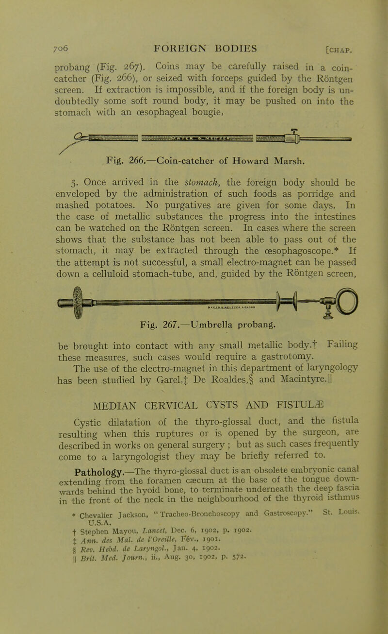 probang (Fig. 267). Coins may be carefully raised in a coin- catcher (Fig. 266), or seized with forceps guided by the Rontgen screen. If extraction is impossible, and if the foreign body is un- doubtedly some soft round body, it may be pushed on into the stomach with an oesophageal bougie, . Fig. 266.—Coin-catcher of Howard Marsh. 5. Once arrived in the stomach, the foreign body should be enveloped by the administration of such foods as porridge and mashed potatoes. No purgatives are given for some days. In the case of metaUic substances the progress into the intestines can be watched on the Rontgen screen. In cases where the screen shows that the substance has not been able to pass out of the stomach, it may be extracted through the oesophagoscope.* If the attempt is not successful, a small electro-magnet can be passed down a celluloid stomach-tube, and, guided by the Rontgen screen. Fig. 267.—Umbrella probang. be brought into contact with any small metallic body.t Failing these measures, such cases would require a gastrotomy. The use of the electro-magnet in this department of lar5nigology has been studied by Garel4 De Roaldes,§ and Macintyre.|| MEDIAN CERVICAL CYSTS AND FISTUL.E Cystic dilatation of the thyro-glossal duct, and the fistula resulting when this ruptures or is opened by the surgeon, are described in works on general surgery ; but as such cases frequently come to a laryngologist they may be briefly referred to. Pathology.—The thyro-glossal duct is an obsolete embrj-onic canal extending from the foramen caecum at the base of the tongue down- wards behind the hyoid bone, to terminate underneath the deep fascia in the front of the neck in tlie neighbourhood of the thyroid isthmus * Chevalier Jackson, Tracheo-Bronchoscopy and Gastroscopy. St. Louis. U.S.A. t Stephen Mayou, Lancet, Dec. 6, 1902, p. 1902. X Ann. des Mai. de VOreille, Vhv., igoi. § Rev. Hehd. de Laryngol., Jan. 4, 1902. II Brit. Med. Jown., ii., Aug. 30, 1902, p. 572-