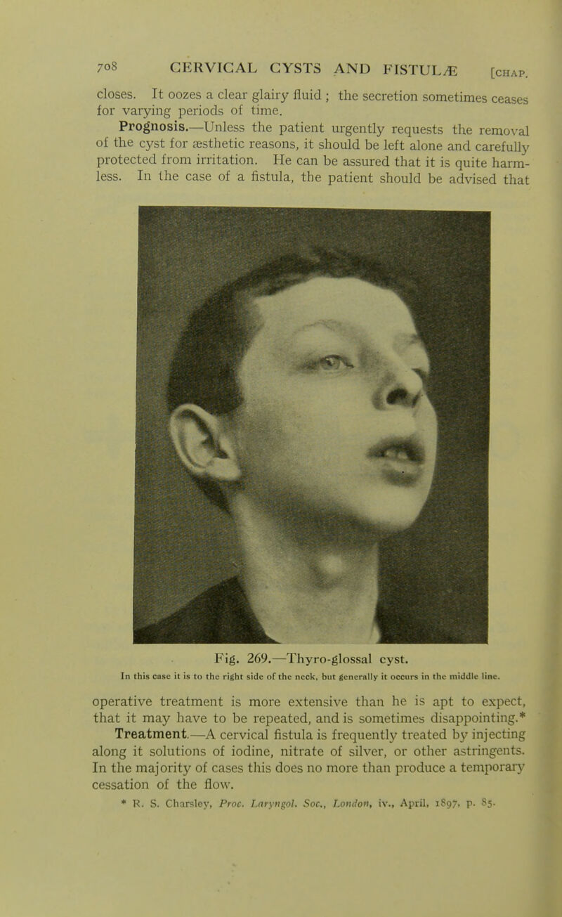 closes. It oozes a clear glairy fluid ; the secretion sometimes ceases for varying periods of time. Prognosis.—Unless the patient urgently requests the removal of the cyst for aesthetic reasons, it should be left alone and carefully protected from irritation. He can be assured that it is quite harm- less. In the case of a fistula, the patient should be advised that Fig. 269.—Thyro-glossal cyst. In this case it is to the right side of the neck, but generally it occurs in the middle line. operative treatment is more extensive than he is apt to expect, that it may have to be repeated, and is sometimes disappointing.* Treatment.—A cervical fistula is frequent^ treated by injecting along it solutions of iodine, nitrate of silver, or other astringents. In the majority of cases this does no more than produce a temporar}' cessation of the flow. * K. S. Charsley, Proc. LnryngoU Soc, London, iv., April, 1897, P- 85.