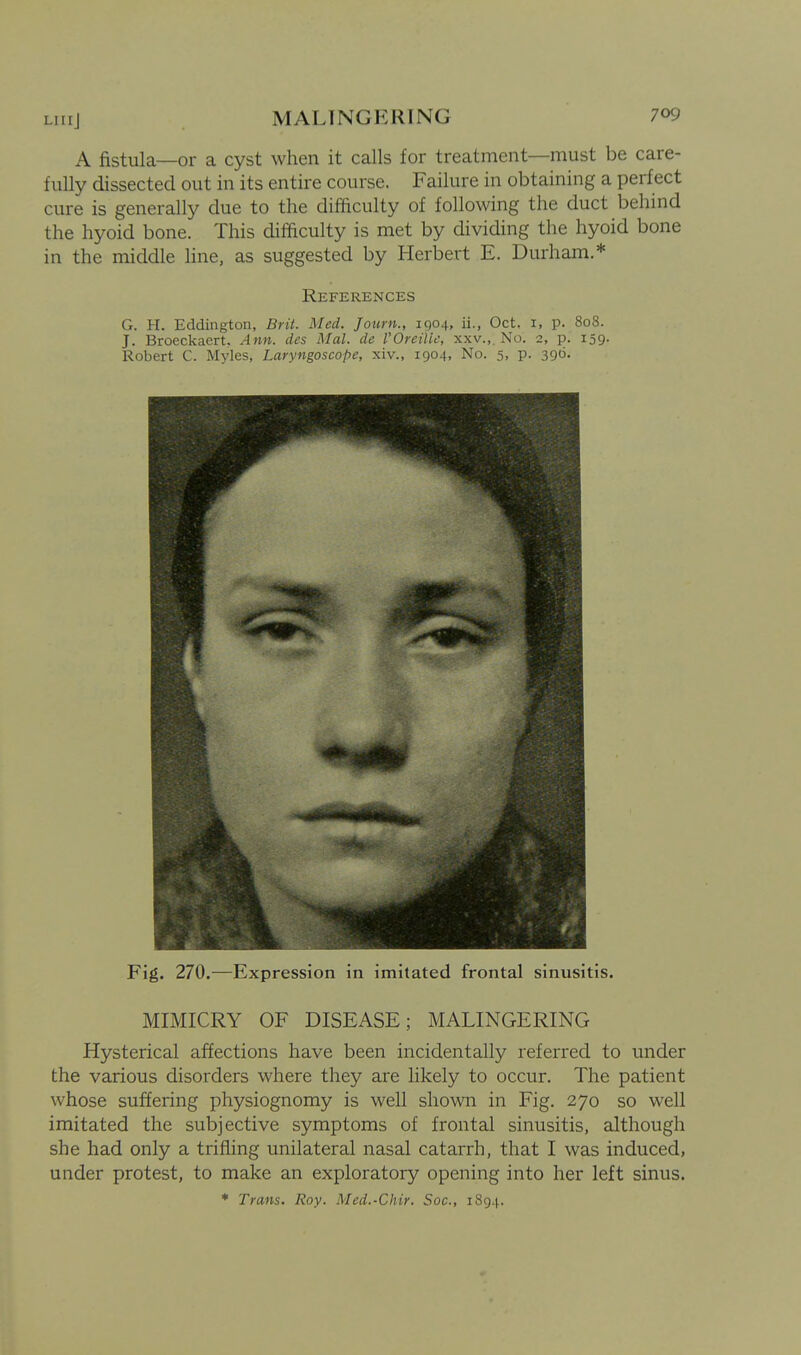 A fistula—or a cyst when it calls for treatment—must be care- fully dissected out in its entire course. Failure in obtaining a perfect cure is generally due to the difficulty of following the duct behind the hyoid bone. This difficulty is met by dividing the hyoid bone in the middle line, as suggested by Herbert E. Durham.* References G. H. Eddington, Brit. Med. Jotirn., 1904, ii., Oct. i, p. 808. J. Broeckaert. Ann. des Mai. de VOreilic, xxv.,. No. 2, p. 159- Robert C. Myles, Laryngoscope, xiv., 1904, No. 5, p. 396. Fig. 270.—Expression in imitated frontal sinusitis. MIMICRY OF DISEASE; MALINGERING Hysterical affections have been incidentally referred to under the various disorders where they are likely to occur. The patient whose suffering physiognomy is well shown in Fig. 270 so well imitated the subjective symptoms of frontal sinusitis, although she had only a trifling unilateral nasal catarrh, that I was induced, under protest, to make an exploratory opening into her left sinus. * Trans. Roy. Med.-Chir. Soc, 1894.