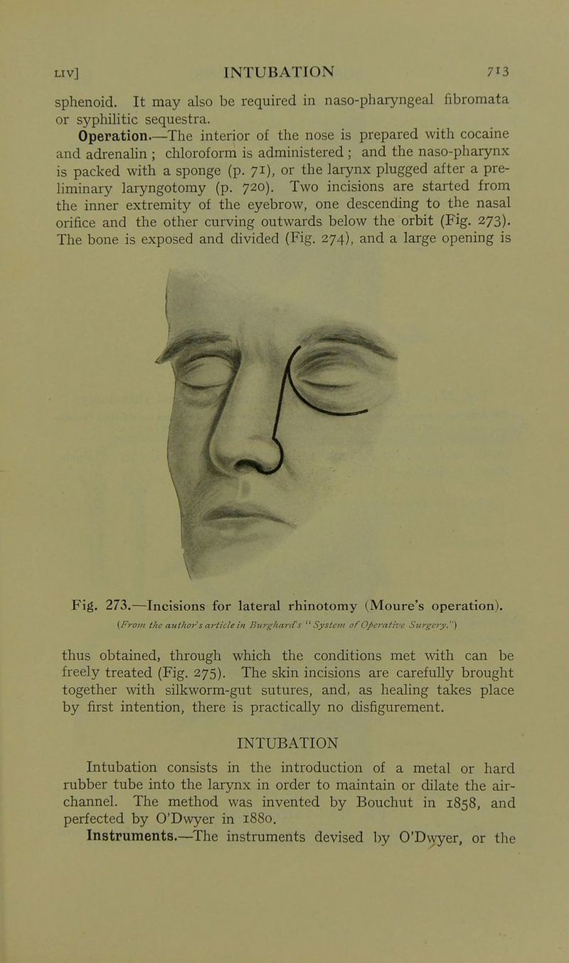 sphenoid. It may also be required in naso-pharyngeal fibromata or syphilitic sequestra. Operation The interior of the nose is prepared with cocaine and adrenalin ; chloroform is administered ; and the naso-pharynx is packed with a sponge (p. 71), or the larynx plugged after a pre- liminary laryngotomy (p. 720). Two incisions are started from the inner extremity of the eyebrow, one descending to the nasal orifice and the other curving outwards below the orbit (Fig. 273). The bone is exposed and divided (Fig. 274), and a large opening is Fig. 273.—Incisions for lateral rhinotomy (Moure's operation). {From the author's article in Biirghard's System of Operative Surgery.) thus obtained, through which the conditions met with can be freely treated (Fig. 275). The skin incisions are carefully brought together with silkworm-gut sutures, and, as healing takes place by first intention, there is practically no disfigurement, INTUBATION Intubation consists in the introduction of a metal or hard rubber tube into the larynx in order to maintain or dilate the air- channel. The method was invented by Bouchut in 1858, and perfected by O'Dwyer in 1880. Instruments.—^The instruments devised by O'Dwyer, or the