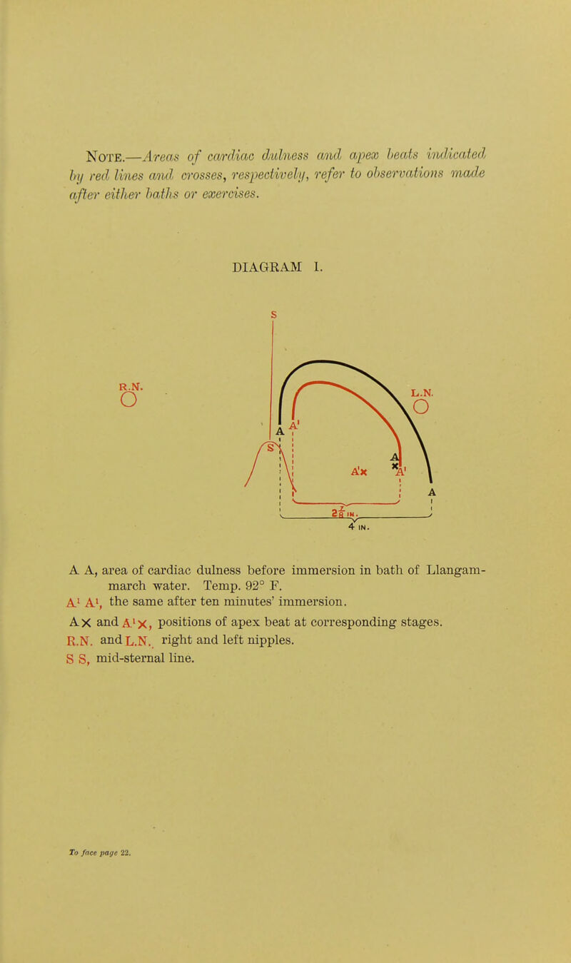 ;t^OTE.—Areas of cardiac dulness and apex heats indicated hy red lines and crosses, respeciivehj, refer to observations made after either haths or exercises. DIAGRAM 1. s 4 IN. A A, area of cardiac dulness before immersion in bath of Llangam- march water. Temp. 92° F. A^ A', the same after ten minutes' immersion. Ax and A'X, positions of apex beat at corresponding stages. R.N. and L.N. right and left nipples. S S, mid-sternal line.