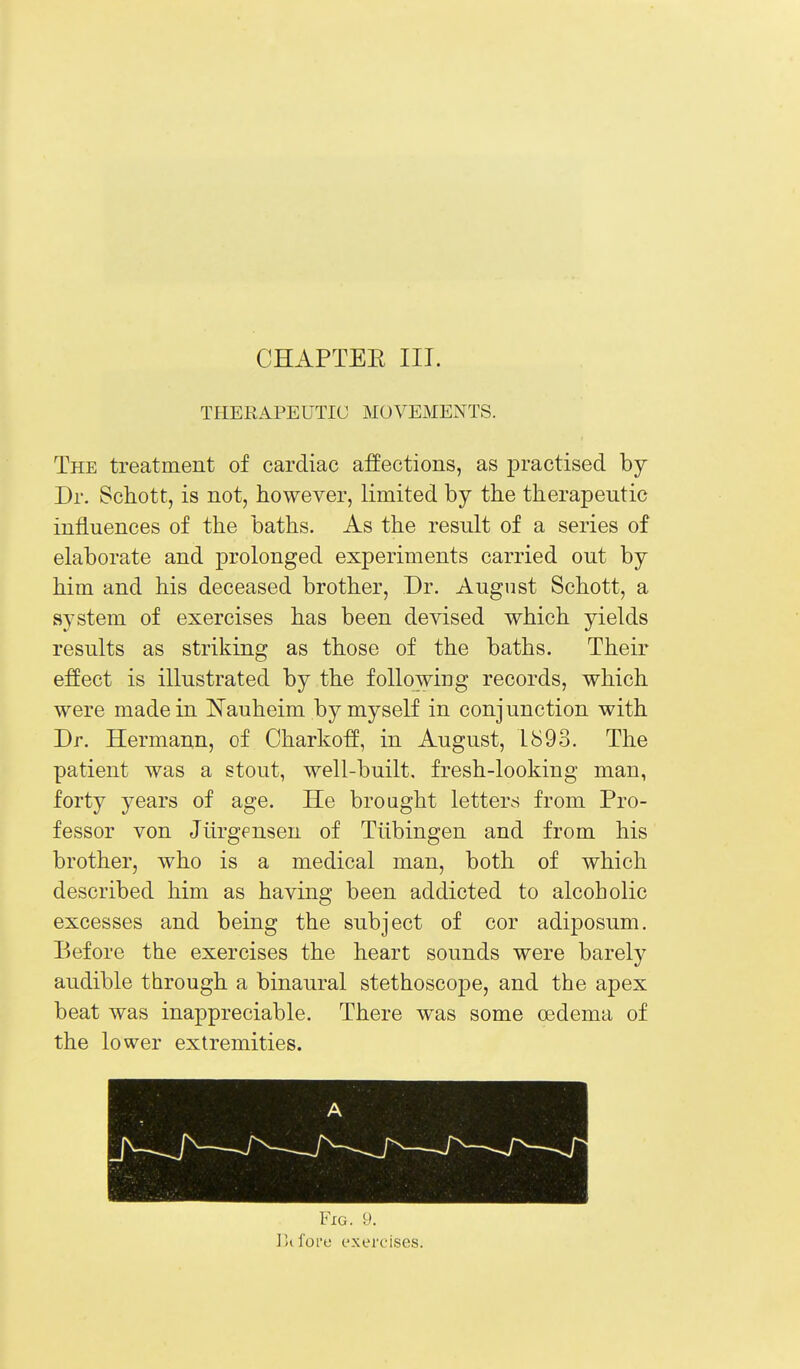 CHAPTEE III. THERAPEUTIC MOVEMENTS. The treatment of cardiac affections, as practised by Dr. Schott, is not, however, limited by tbe therapeutic influences of the baths. As the result of a series of elaborate and prolonged experiments carried out by him and his deceased brother, Dr. August Schott, a system of exercises has been devised which yields results as striking as those of the baths. Their effect is illustrated by the following records, which were made in I^auheim by myself in conjunction with Dr. Hermann, of Charkoff, in August, 1893. The patient was a stout, well-built, fresh-looking man, forty years of age. He brought letters from Pro- fessor von Jiirgensen of Tubingen and from his brother, who is a medical man, both of which described him as having been addicted to alcoholic excesses and being the subject of cor adiposum. Before the exercises the heart sounds were barely audible through a binaural stethoscope, and the apex beat was inappreciable. There was some oedema of the lower extremities. Fig. 9. ]>ifore exercises.