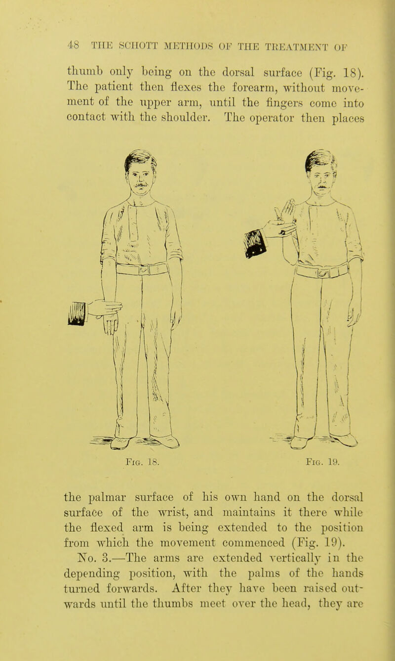 thumb only being on the dorsal surface (Fig. 18). The patient then flexes the forearm, without move- ment of the upper arm, until the fingers come into contact with the shoulder. The operator then places Fig. 18. Fig. 19. the palmar surface of his own hand on the dorsal surface of the wrist, and maintains it there while the flexed arm is being extended to the position from which the movement commenced (Fig. 19). ISio. 3.—The arms are extended verticall)^ in the depending position, with the palms of the hands turned forwards. After they have been raised out- wards until the thumbs meet over the head, they are