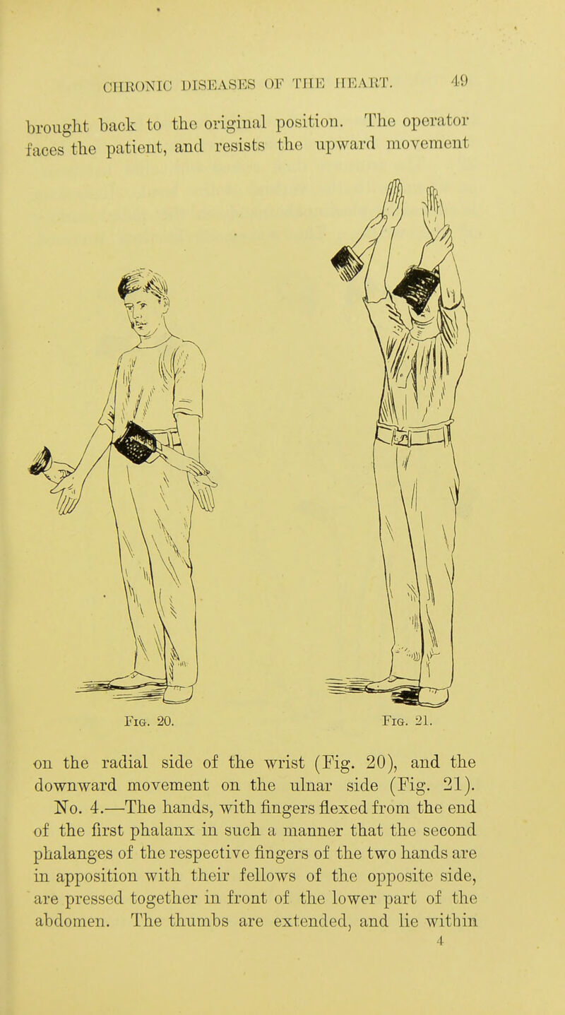 brought back to the original position. The operator faces^the patient, and resists the upward movement Fig. 20. Fig. 21. on the radial side of the wrist (Fig. 20), and the downward movement on the ulnar side (Fig. 21). Ko. 4.—The hands, with fingers flexed from the end of the first phalanx in such a manner that the second phalanges of the respective fingers of the two hands are in apposition with their fellows of the opposite side, are pressed together in front of the lower part of the abdomen. The thumbs are extended, and lie within 4