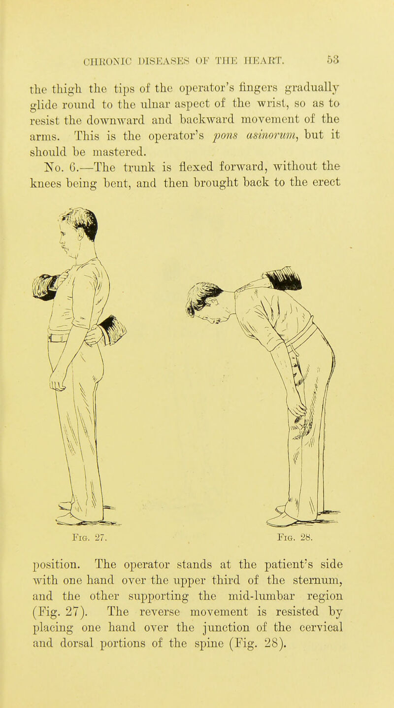 the thigh the tips of the operator's fingers gradually glide round to the ulnar aspect of the wrist, so as to resist the downward and backward movement of the arms. This is the operator's pons asinorum, but it should be mastered. No. 6.—The trunk is flexed forward, without the knees being bent, and then brought back to the erect Fig. 27. _ Fig. 28. position. The operator stands at the patient's side Avith one hand over the upper third of the sternum, and the other supporting the mid-lumbar region (Fig. 27). The reverse movement is resisted by placing one hand over the junction of the cervical and dorsal portions of the spine (Fig. 28).