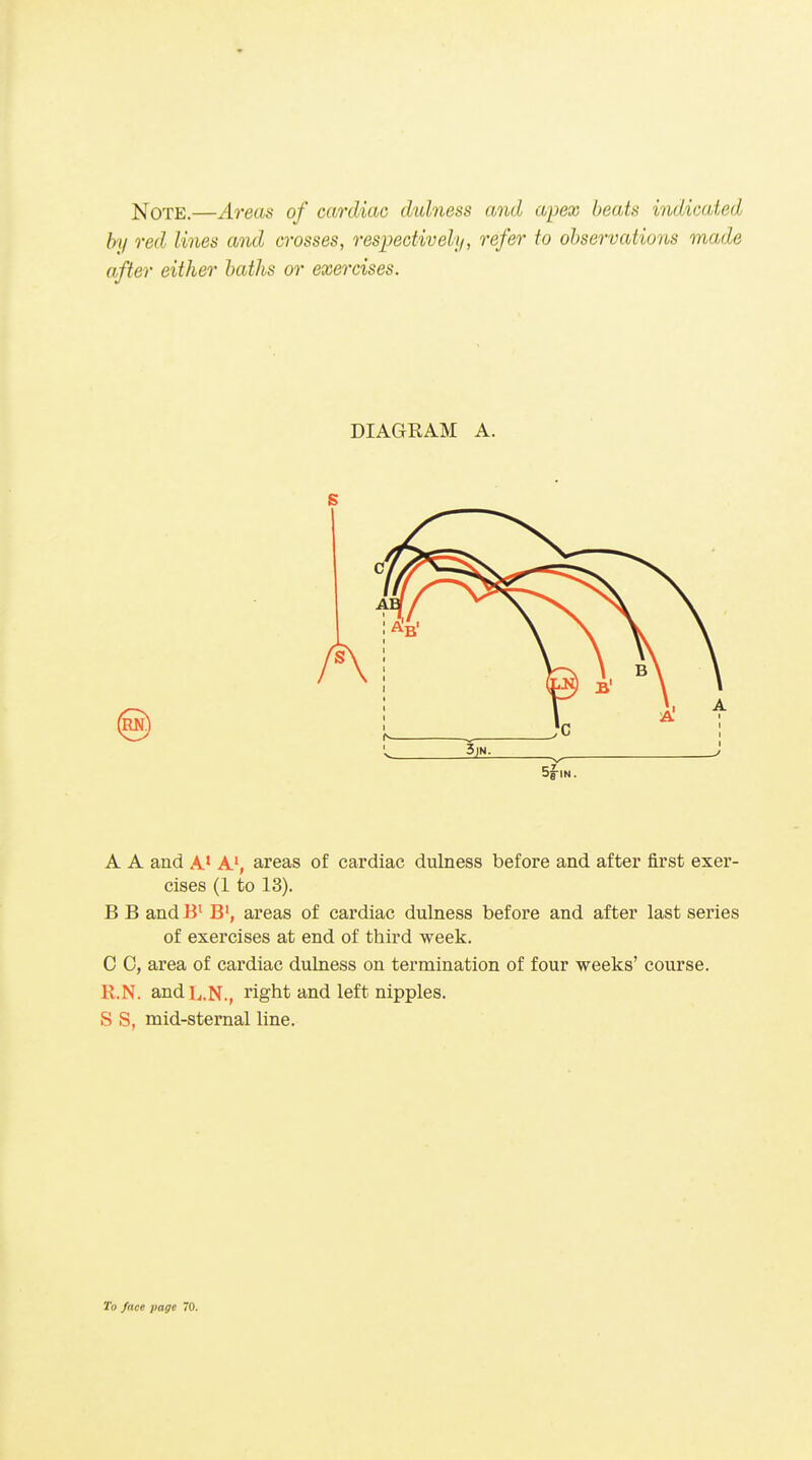 jsj'OTE.—Areas of cardiac dulness and ajjex beats indicated bij red lines and crosses, respectively, refer to observations made after either baths or exercises. DIAGRAM A. A A and A* A', areas of cardiac dulness before and after first exer- cises (1 to 13). B B andB^ B', areas of cardiac dulness before and after last series of exercises at end of third week. C 0, area of cardiac dulness on termination of four weeks' course. K.N. and L,N., right and left nipples. S S, mid-sternal line.