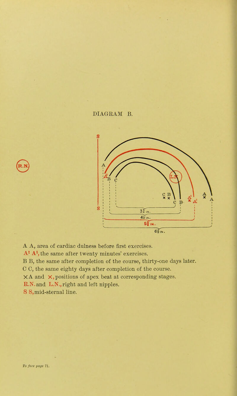 S A A, area of cardiac dulness before first exercises. A* A^, the same after twenty minutes' exercises. B B, the same after completion of the com'se, thirty-one days later. C C, the same eighty days after completion of the course. X A and X, positions of apex beat at corresponding stages. R.N. and L.N., right and left nipples. S S, mid-sternal line.