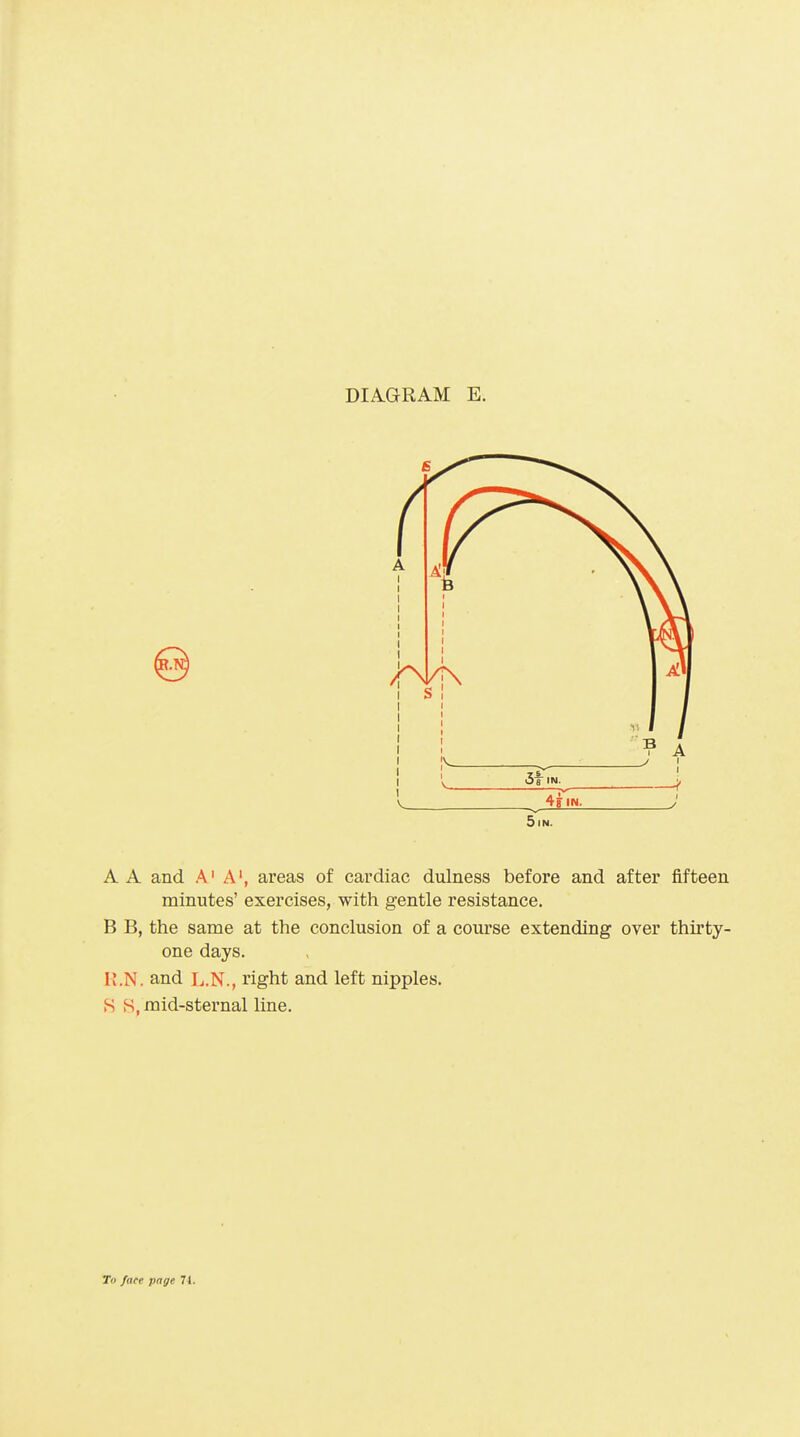 \ 4? IN. 5lN. A A and A' A', areas of cardiac dulness before and after fifteen minutes' exercises, with gentle resistance. B B, the same at the conclusion of a course extending over thirty- one days. K.N. and L.N., right and left nipples. S S, mid-sternal line.