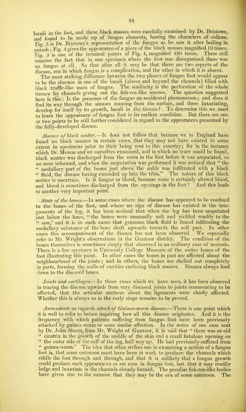 loculi in the foot, and these black masses were carefully examined by Dr. Bristowe, and found to be made up of fungus elements, having the characters of oidium. Fig. 3 is Dr. Bristowe's representation of the fungus as he saw it after boiling in potash ; Fio-. 4 gives the appearance of a piece of the black masses magnified 10 times. Fio-. 3'is one of the terminal points of Fig. 4, magnified 420 times. There still remains the fact that in one specimen where the foot was disorganised there was no fungus at all. So that after all it may be that there are two aspects of the disease one in which fungus is a complication, and the other in which it is absent. The most striking difference between the two phases of fungus foot would appear to be the absence in one of the loculi (above and beyond the channels) filled with black truffle-hke mass of fungus. The similarity is the perforation of the whole tissues by channels giving out the fish-roe-like masses. The question suggested here is this: Is the presence of the fungus an accidental phenomenon; and does it find its way through the sinuses ruiming from the surface, and there luxuriating, develop for itself by its growth, loculi in the tissues ? To determine this we need to learn the appearance of fungus foot in its earliest condition. But there are one or two points to be still further considered in regard to the appearances presented by the fully-developed disease. Absence o f black matter.—It does not follow that because vre in England have found no black masses in certain cases, that they may not have existed to some extent in specimens prior to their being sent to this country; for in the instance which Dr. Moxon and we ourselves examined, and in which no trace could be found, black matter was discharged from the sores in the foot before it was amputated, so we were informed, and when the amputation was performed it was noticed that  the  medullary part of the bones just above the ankle was infiltrated with a black  fluid, the disease having extended up into the tibia. The nature of this black matter is uncertain. Is it fungus or blood, because some is certainly altered blood, and blood is sometimes discharged from the openings in the foot ? And this leads to another very important point. State of the bones.— In some cases where the disease has appeared to be confined to the bones of the foot, and where no sign of disease has existed in the inte- guments of the leg, it has been noticed that when the leg has been amputated just below the knee,  the bones were unusually soft and yielded readily to the  saw, and it is in such cases that grumous black fluid is found infiltrating the medullary substance of the bone shaft upwards towards the soft part. In other cases this accompanisnent of the disease has not been observed. We especially refer to Mr. Wright's observations in the Guntoor district. The condition of the bones themselves is sometimes simply that observed in an ordinary case of necrosis. There is a fine specimen in University College Museum of the entire bones of the foot illustrating this point. In other cases the bones in part are affected about the neighbourhood of the joints ; and in others, the bones are shelled out completely in parts, forming the walls of cavities enclosing black masses. Sinuses always lead down to the diseased bones. Joints and cartilages.—In those cases which we have seen, it has been observed in tracing the disease upwards from very diseased joints to joints commencing to be affected, that the articular surfaces about the ligaments were chiefly affected. Whether this is always so in the early stage remains to be proved. Antecedents as regards attack of Guinea-worm disease.—There is one point which it is well to refer to before inquiring how all this disease originates. And it is the frequency with which patients suffering from fungus foot iiave been previously attacked by guinea-worm or some similar affection. In the notes of one case sent by Dr. John Shortt, from Mr. Wright of Guntoor, it is said that  there was an old  cicatrix in the growth of the middle of the skin and a small fistulous opening on  the outer side of the calf of the leg, half way up. He had previously suffered from  guinea-worm. The idea that often strikes one in examining a section of a fungus foot is, that some entozoon must have been at work to produce the channels which riddle the foot through and through, and that it is unlikely that a fungus growth could produce such appearances as are seen in fungus foot, but that it may readiljr lodge and luxuriate in the channels already formed. The peculiar fish-roe-like bodies have given rise to the surmise that they may be the ova of some entozoon. The