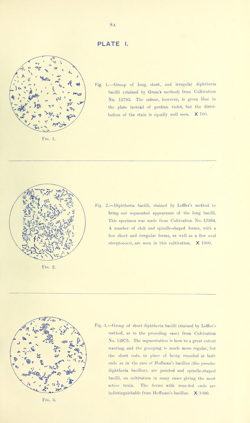 8a PLATE I. Fig. 1.—Group of long, short, and irregular diphtheria bacilli (stained by Gram's method) from Cultivation No. 12793. The colour, however, is given blue in the plate instead of gentian violet, but the distri- bution of the stain is equally well seen. X 700. Fig. Fig. 2.—Diphtheria bacilli, stained by Loffler's method to bring out segmented appearance of the long bacilli. This specimen was made from Cultivation No. 13394. A number of club and spindle-shaped forms, with a few short and irregular forms, as well as a few oval streptococci, are seen in this cultivation. X 1000. Fig. 2. 3.—Group of short diphtheria bacilli (stained by Loffler's jnethod, as in the preceding case) from Cultivation No. 12975. The segmentation is here to a great extent wanting, and the grouping is much more regular, but the short rods, in place of being rounded at both ends as in the case of Hoffman's bacillus (the pseudo- diphtheria bacillus), are pointed and spindle-shaped bacilli, on cultivation in many cases giving the most active toxin. The forms with rounded ends are indistinguishable from Hoffman's bacillus. X 1000, Fig. 3.