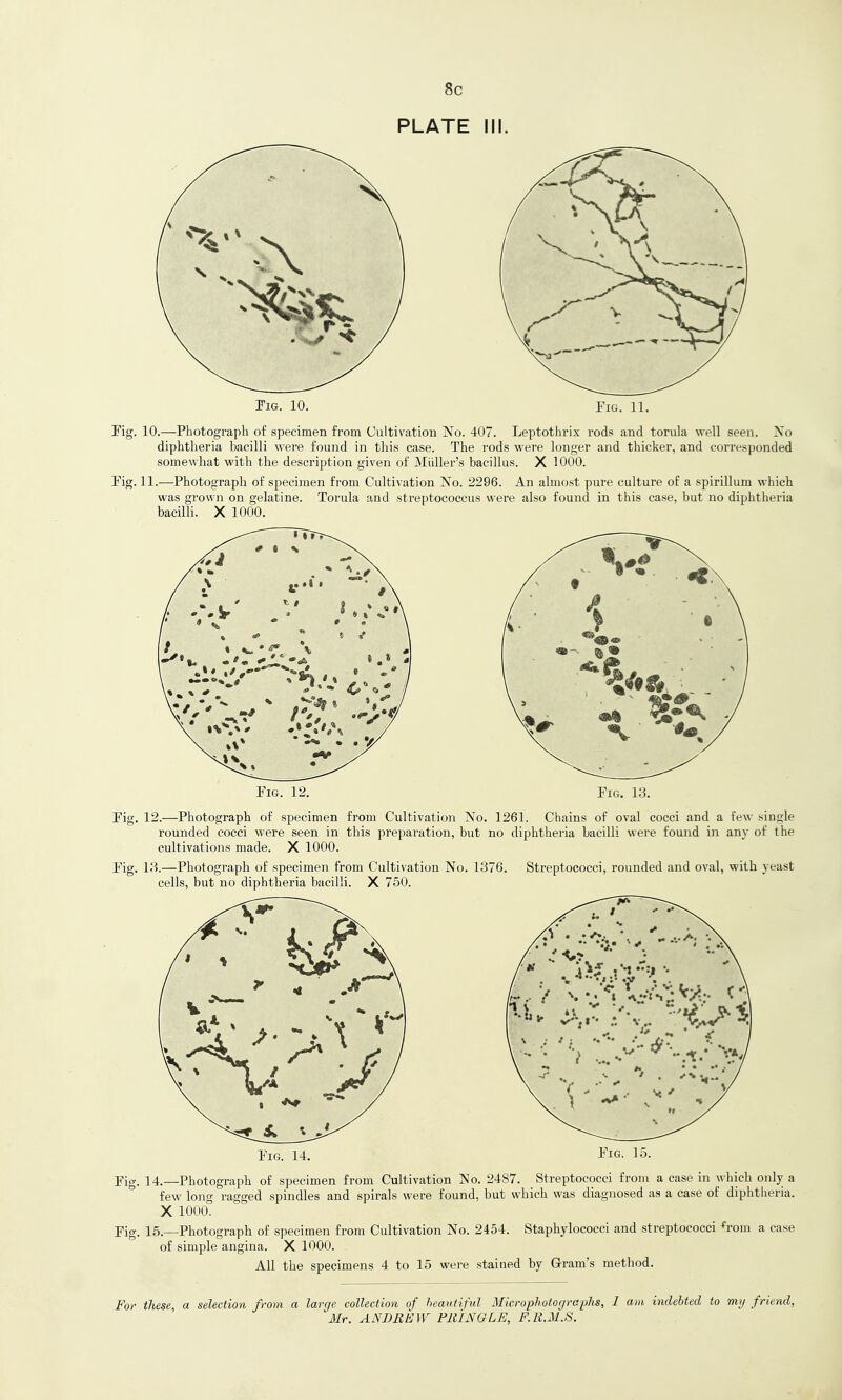 8c PLATE III. IiG. 10. Fig. 11. Fig. 10.—Photograph of specimen from Cultivation No. 407. Leptothrix rods and torula well seen. Xo diphtheria bacilli were found in this case. The rods were longer and thicker, and eorres])onded somewhat with the description given of Miiller's bacillus. X 1000. rig. 11.—Photograph of specimen from Cultivation No. 2296. An almost pure culture of a spirillum which was grown on gelatine. Torula and streptococcus were also found in this case, but no diphtheria bacilli. X 1000. Pi&. 12. Fig. 13. Fig. 12.—Photograph of specimen from Cultivation No. 1261. Chains of oval cocci and a few single rounded cocci were seen in this preparation, but no diphtheria bacilli were found in any of the cultivations made. X 1000. Fig. 13.—Photograph of specimen from Cultivation No. 1376. Streptococci, rounded and oval, with yeast cells, but no diphtheria bacilli. X 750. Fig. 14. Fig- 15- Fig. 14.—Photograph of specimen from Cultivation No. 2487. Streptococci from a case in \^hich only a few long ragged spindles and spirals were found, but which was diagnosed as a case of diphtheria. X 1000. Fig. 15.—Photograph of specimen from Cultivation No. 2454. Staphylococci and streptococci ^'rom a case of simple angina. X 1000. All the specimens 4 to 15 were stained by Gram's method. For these, a selection from a large collection of heauiiful Microphotogra'phs, 1 am indebted to my friend, Mr. ANDREW PIUNGLE, F.li.M.S. , .