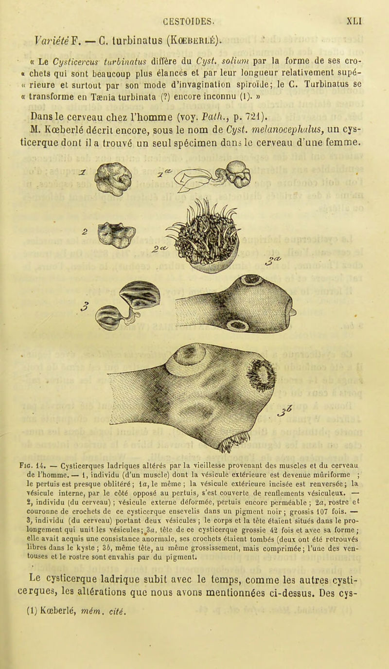 Fm'eVeF. — C. turbinalus (KffiBERi-i!;). « Le Cysticercus turbinatus diff^re du Cyst, solium par la forme de ses cro- « chets qui sont beaucoup plus elances et par leur longueur relativement supe- << rieure el surtout par son mode d'invagination spiroiJe; le C. Turbinatus se a transforme en Taenia turbinata (?) encore inconnu (I). » Dansle cerveau chez I'homme (voy. 'Path., p. 721). M. Koeberl6 d^cril encore, sous le nom de Cyst, melanocephalus, un cys- ticerque dont il a lrouv6 un seul specimen dans le cerveau d'une femme. Fic. 14. — Cyslicerques ladriques allures par la vieiUesse provenant des muscles et du cerveau de rhomme.— 1, individu (d'un muscle) dont la v6sicule exlSrieure est devenue murifome ; le pertuis est presque oblil^r^; la, le raeme ; la \6sicule eit^rieure incisie est renvers^e; la ■v^sicule interne, par le c6t^ oppose au pertuis, s'est couverle de renflements v^siculeux. — 2, individu (du cerveau); v^sicule externe d^formSe, pertuis encore permeable ; 2a, rostre e' couronne de crochets de ce cysticerque ensevelis dans un pigment noir; grossis 107 fois. — 3, individu (du cerveau) portant deux v^sicules ; le corps et la tete ^taient situ^s dans le pro- longement qui unit les Yisicules;^3a, tete de ce cysticerque grossie 42 fois et avec sa forme; ellc avait acquis une consistance anorniale, ses ciocliets (Staient tomb^s (deux ont ^tt5 relrouv^s libres dans le kyste ; 34, meme tSle, au mfime grossisscment, mais comprim^e; I'uae des ven- touses et le rostre sont envahis par du pigment. Le cysticerque ladrique subit avec le temps, comme les autres cysti- cerques, les all6rations que nous avons menlionn^es ci-dessus. Des cys- (1) Kojberle, mim. citi.