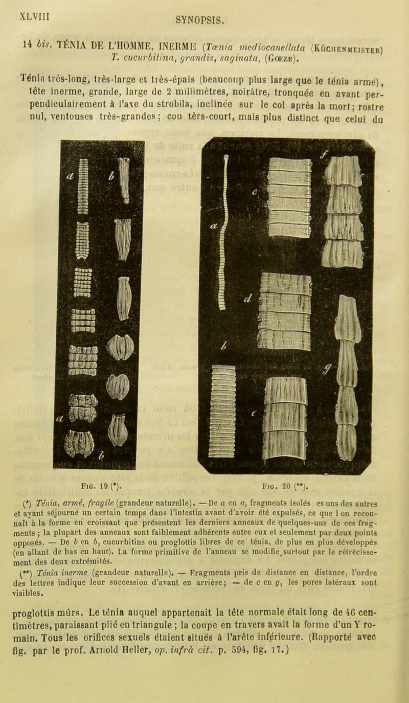 14 Lis. TfiNIA DE L'lIOMME, INERME {Tcinia mediocanellata (KucfiENMEisTgE) T. cucurbilina, yrnndis, saginata, (Goeze). Tdnia tr6s-long, trfes-large et lr6s-epais (beaucoiip plus large que le t^nia arme), tete ineime, grande, large de 2 millimetres, nolralre, tronqu(5e en avant per- pendiculairemeiit i I'axe du strobila, inciine'e sur le col apr^s la morl; rostre nul, ventouses tr6s-grandes; cou t6rs-court, mala plus distinct que celui du Fig. 19(*). Via. 20 {). (') Tenia, armi, fragile (grandeur naturclle). — De a cii a, fragineuts isol^s cs uns des autres et ayant sSjournS un certain temps dans I'intestin avant d'avoir 616 expuls^s, ce que 1 on recon- nait a la forme en croissant que pr^sentent les derniers anneaux de quclques-uns de ccs frag- ments ; la plupart des anneaux sont faiblcment adherents entre cui et seulcment par deux points opposes. — De 6 en b, cucurbitins ou proglottis libres de ce t^uia, de plus en plus ddvelopp^s (en allant de bas en haut). La forme primitive dc I'anneau se modiSe^surlout par le ritrScissc- ment des deux cxtrdmilis. (**) Tenia inerme (grandeur naturellc). — Fragments pris de distance en distance, I'ordrc des lettres indique leur succession d'avant en arriere; — de c en g, les pores lat^raux sont visibles. proglottis murs. Letdnia auquel appartenait la tete normale etait long de4G cen- timetres, paraissant plie en triangule; la coupe en travers avait la fornie d'un Y ro- main. Tous les orifices sexuels etaient situes k I'arSle inferieure. (Rapporte avec fig. par le prof. Arnold Heller, op.infrh cit. p. 594, fig. 17.)